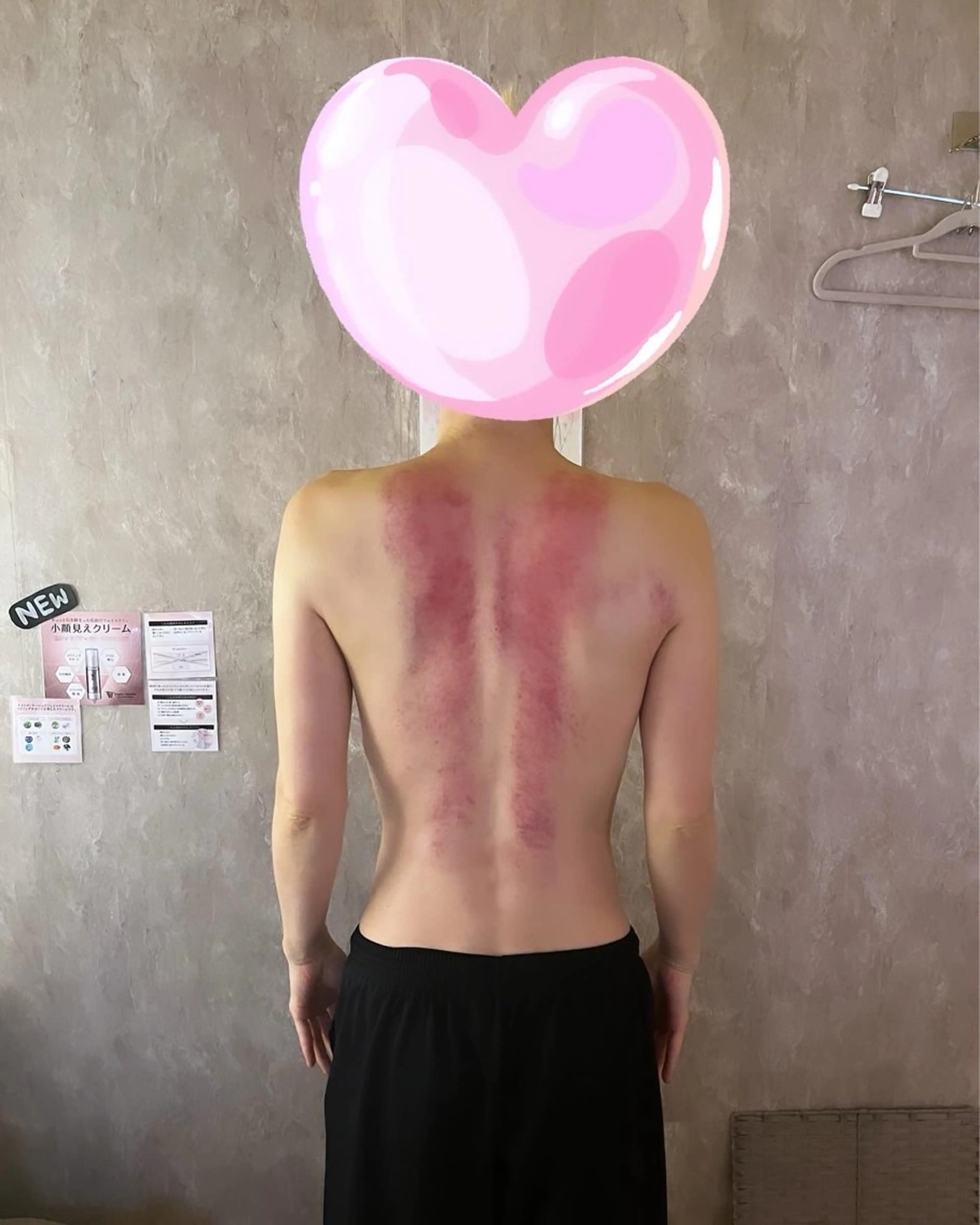 コルギ＆リラクゼーション　Acorde所属・小顔・巻肩・猫背ケア コルギ　Acordeのエステ・リラクイメージ