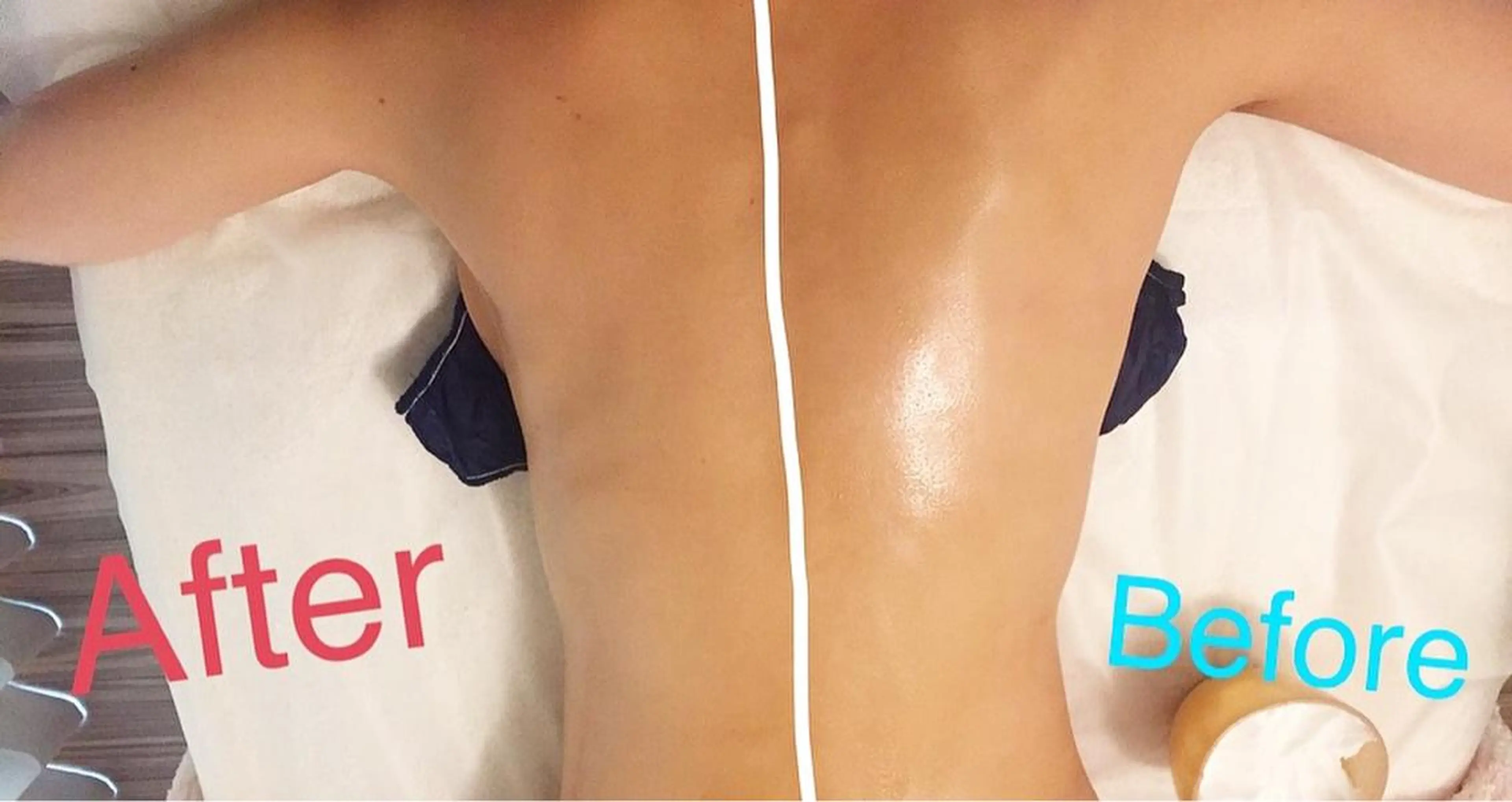 【ニキビ/肌管理】 salon varyのエステ・リラクイメージ