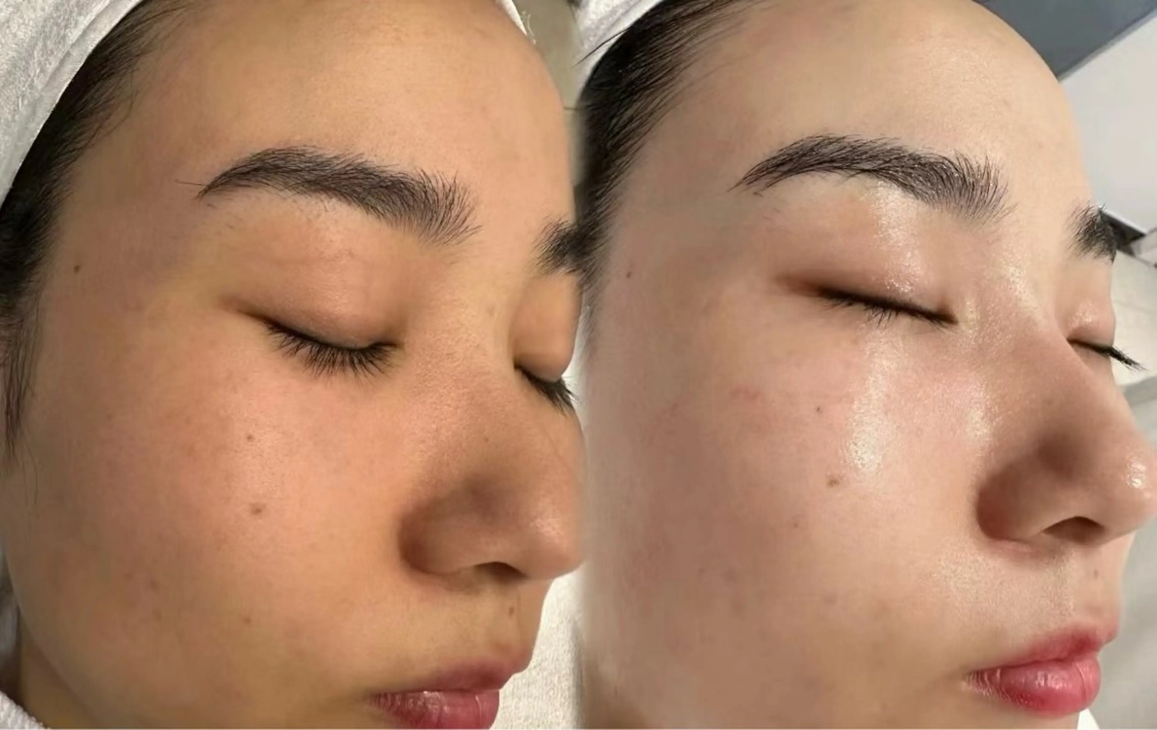 ネイル エステ aliaハイフ&水光ジェットサロン所属・aliaハーブ水光店 エステティシャン募集のエステ・リラクイメージ