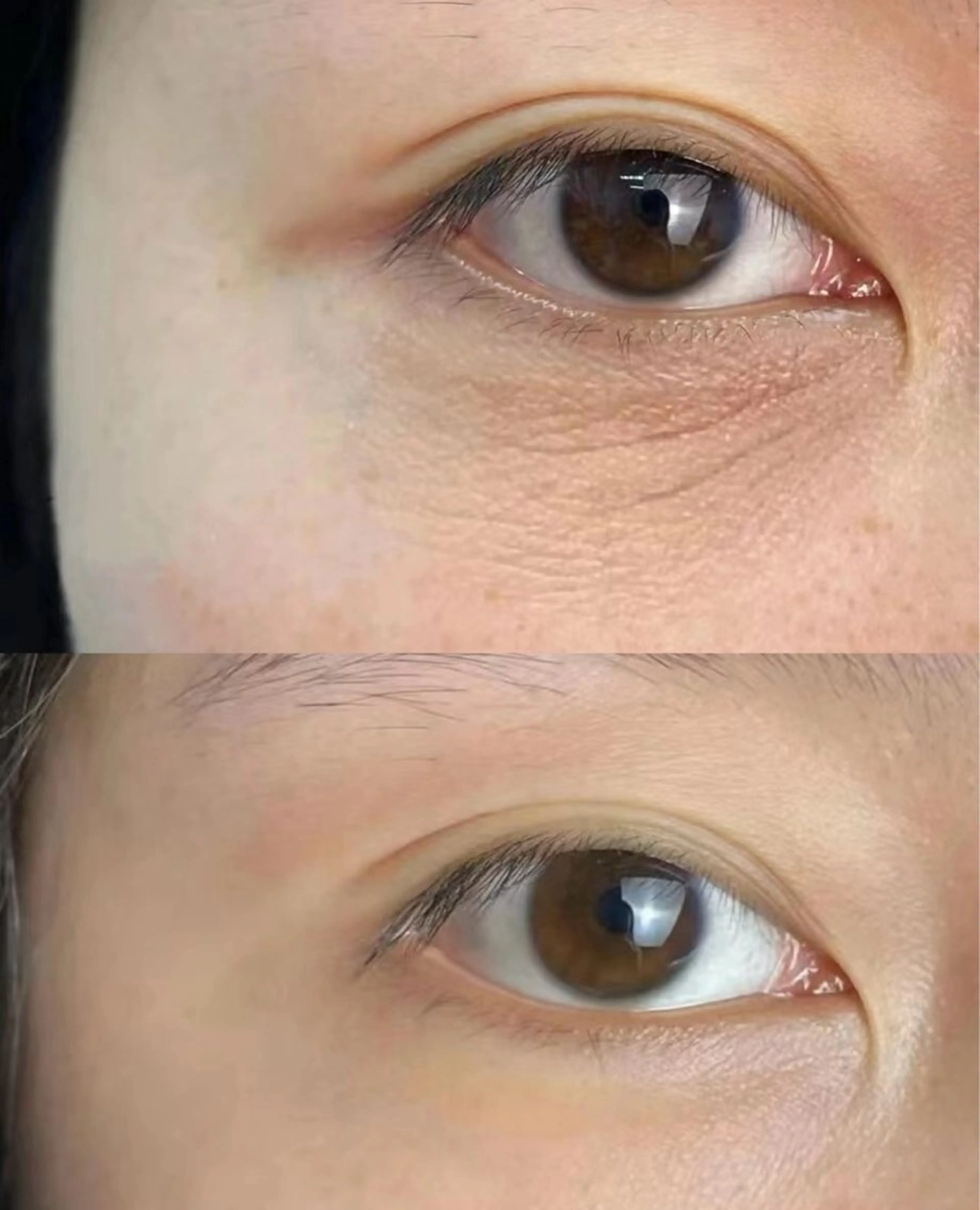 マツエク・マツパ エステ aliaハイフ&水光ジェットサロン所属・aliaハーブ水光店 エステティシャン募集のエステ・リラクイメージ