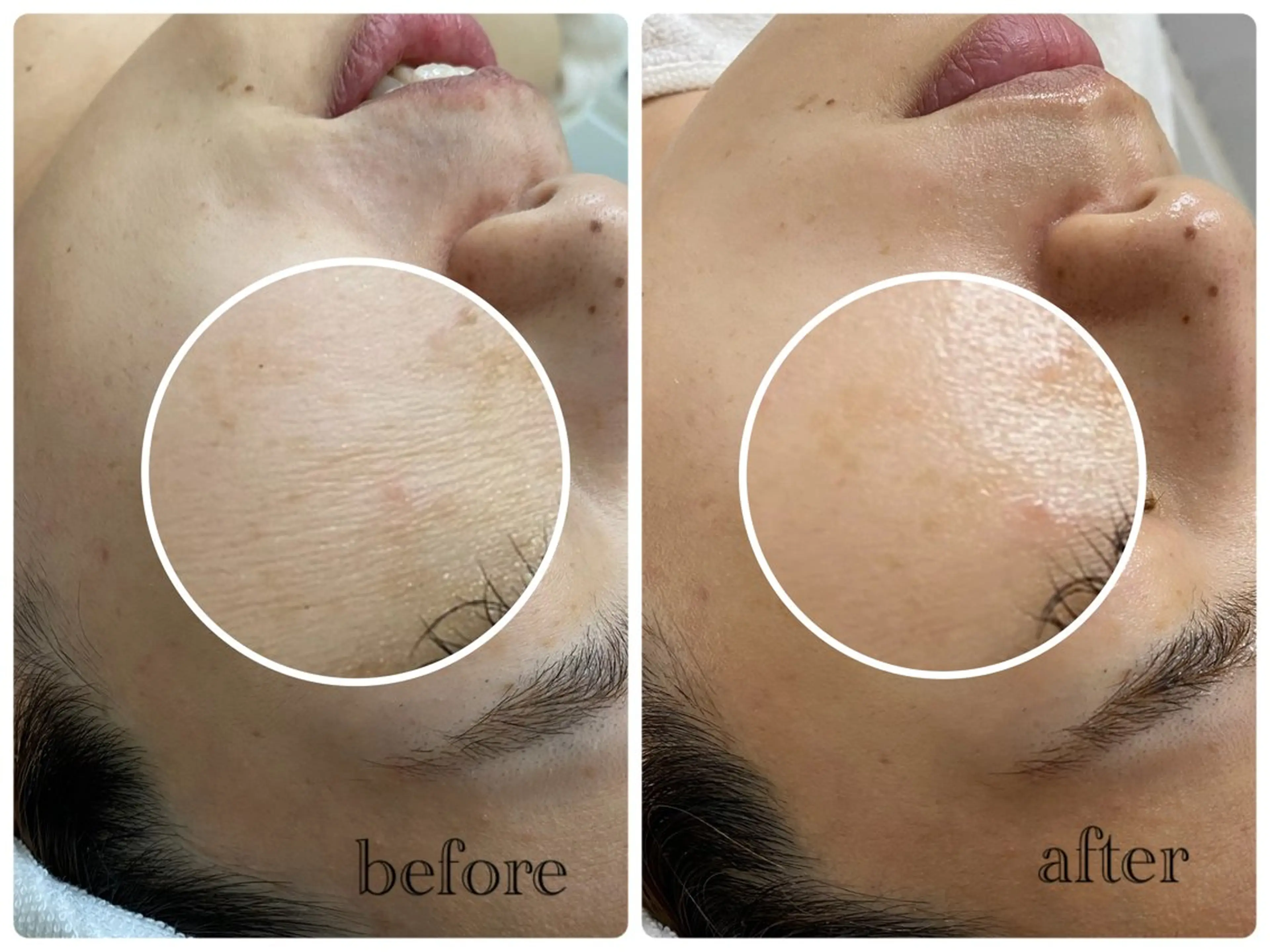 デ・アイム新潟北所属・サイトウ .のエステ・リラクイメージ