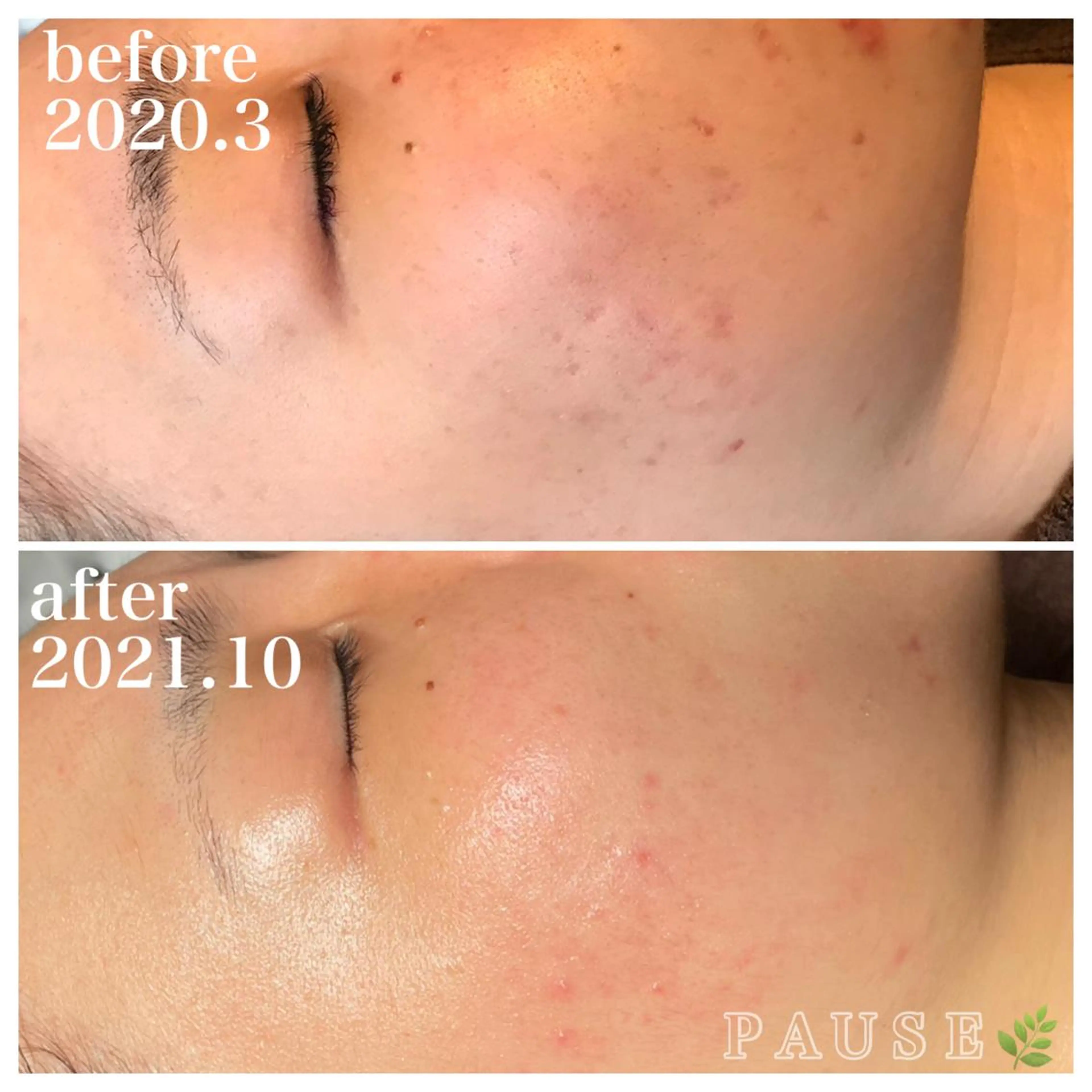 エステ 浜野 恵美のエステ・リラクイメージ