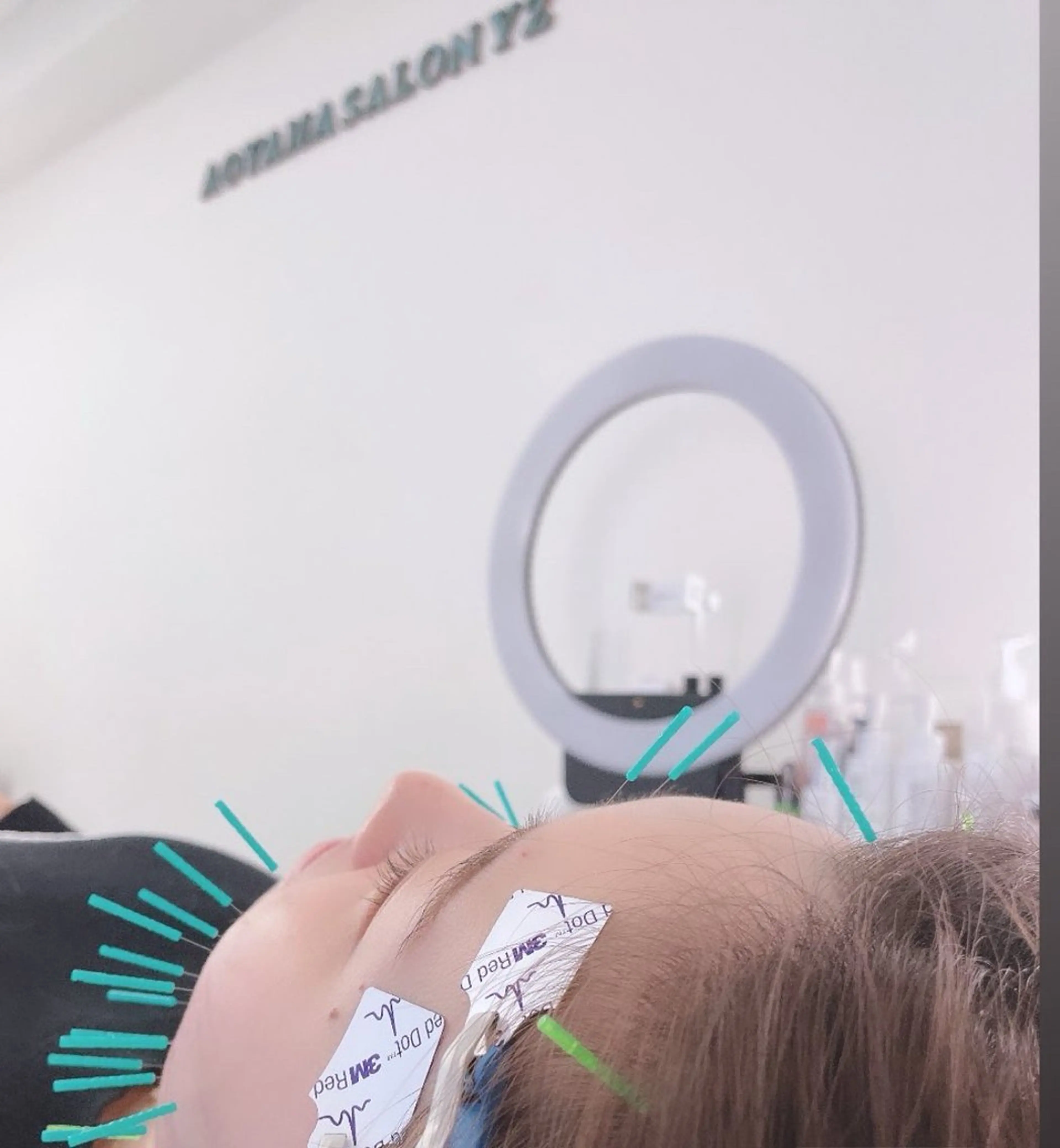 小顔美容鍼専門サロン 渋谷YZのその他イメージ