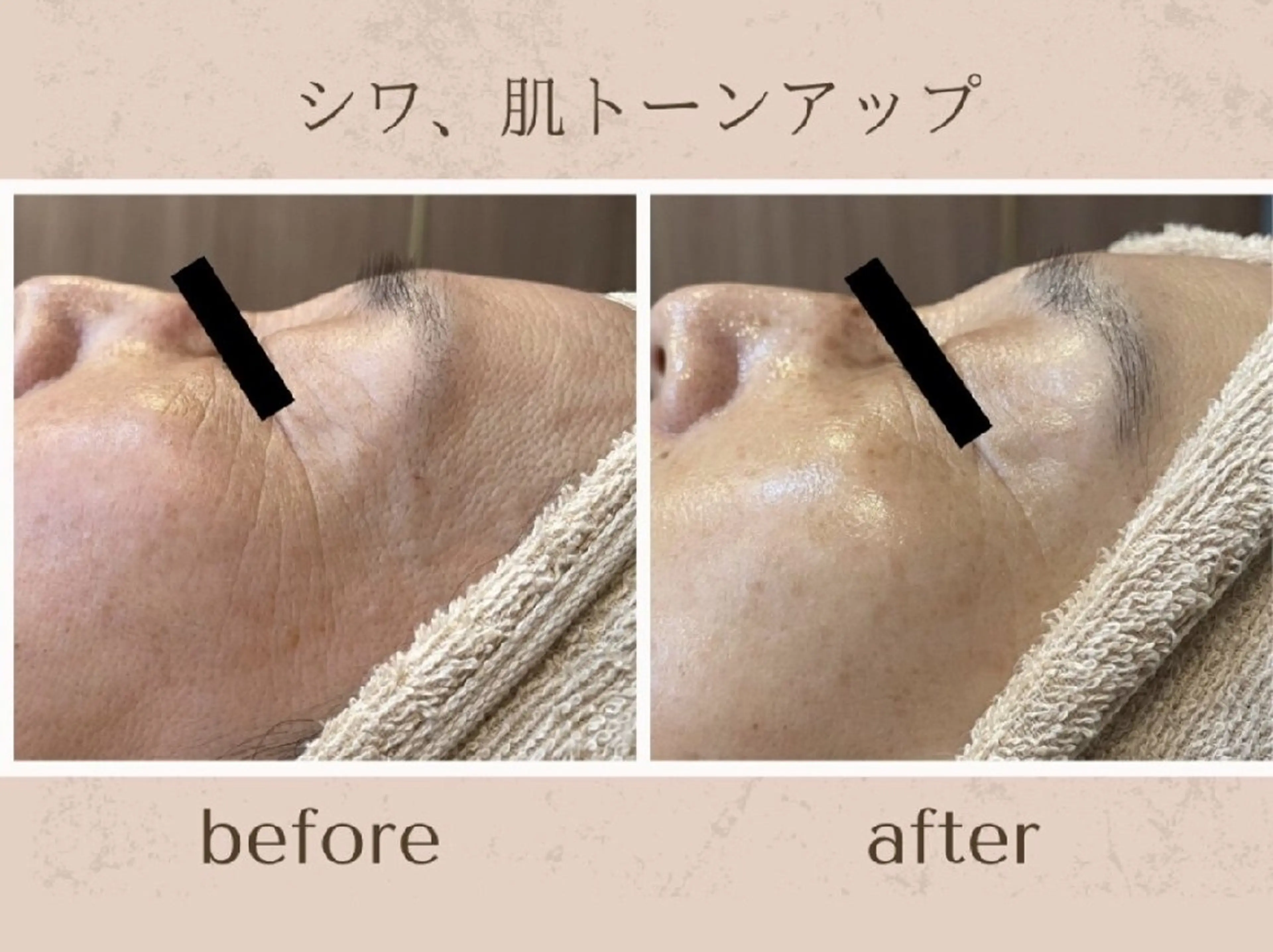 シェービングサロン アンダブル/鴨井のその他イメージ