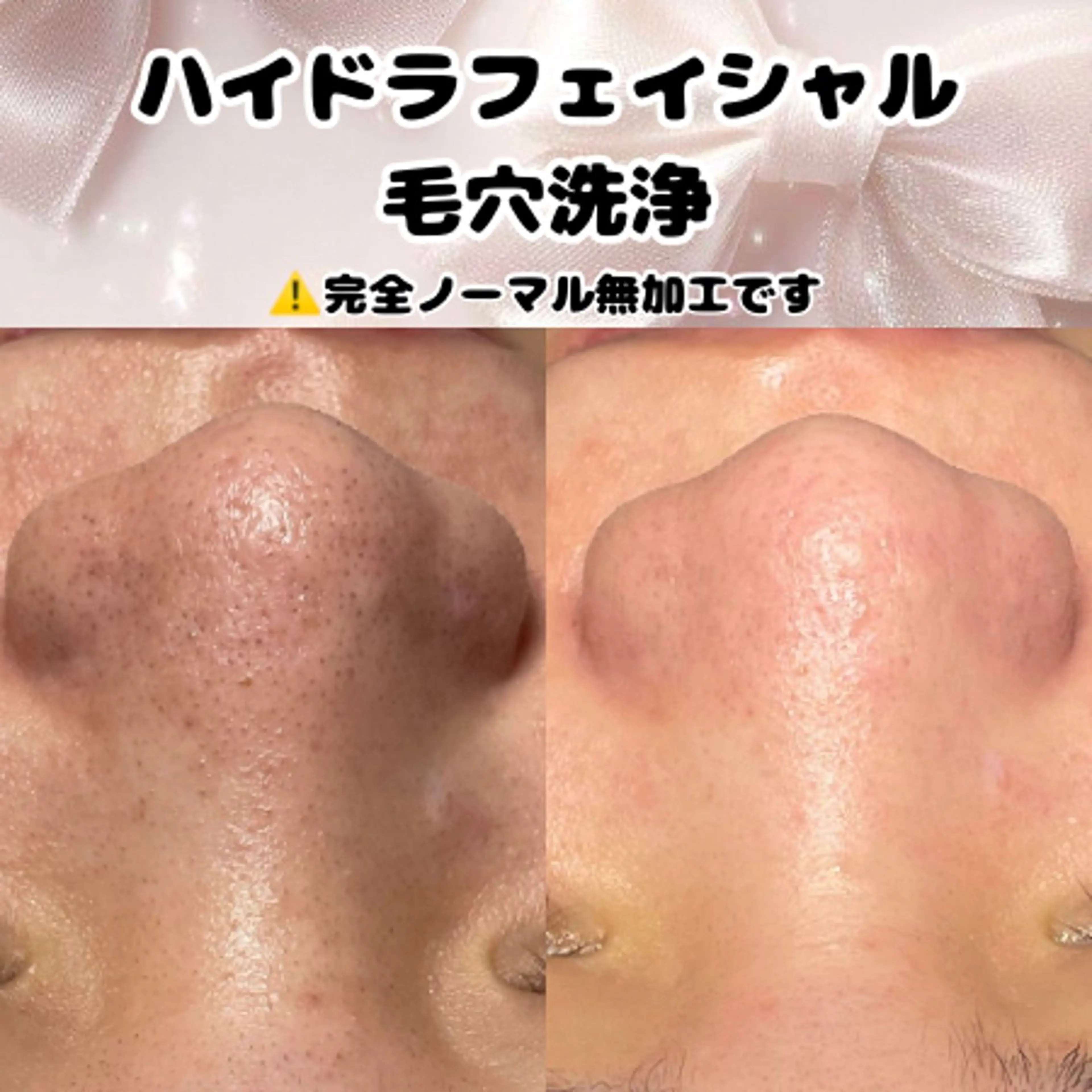 Diailes 💎ななのエステ・リラクイメージ