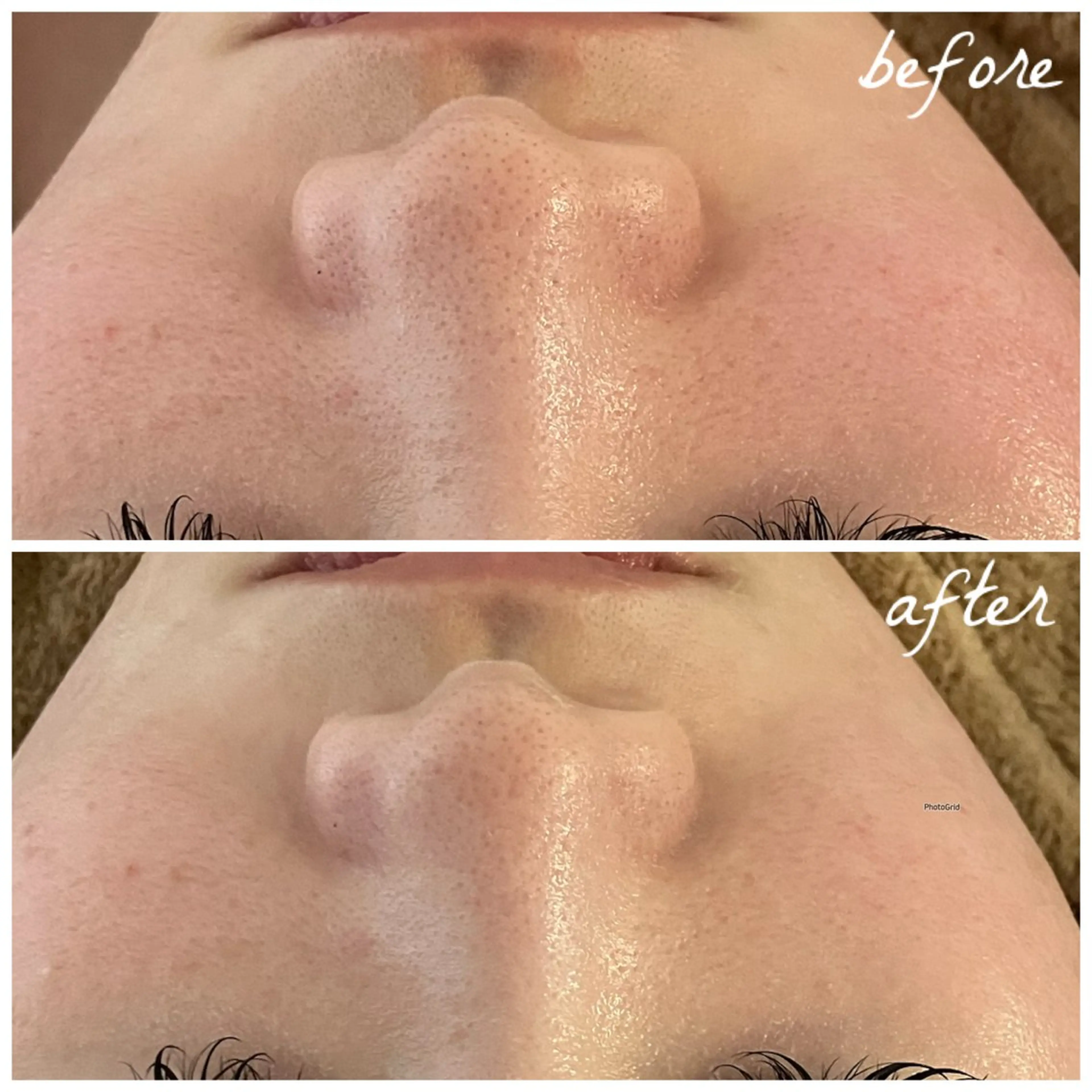 メンズ エステ メナード岐阜茜部 杉浦のエステ・リラクイメージ