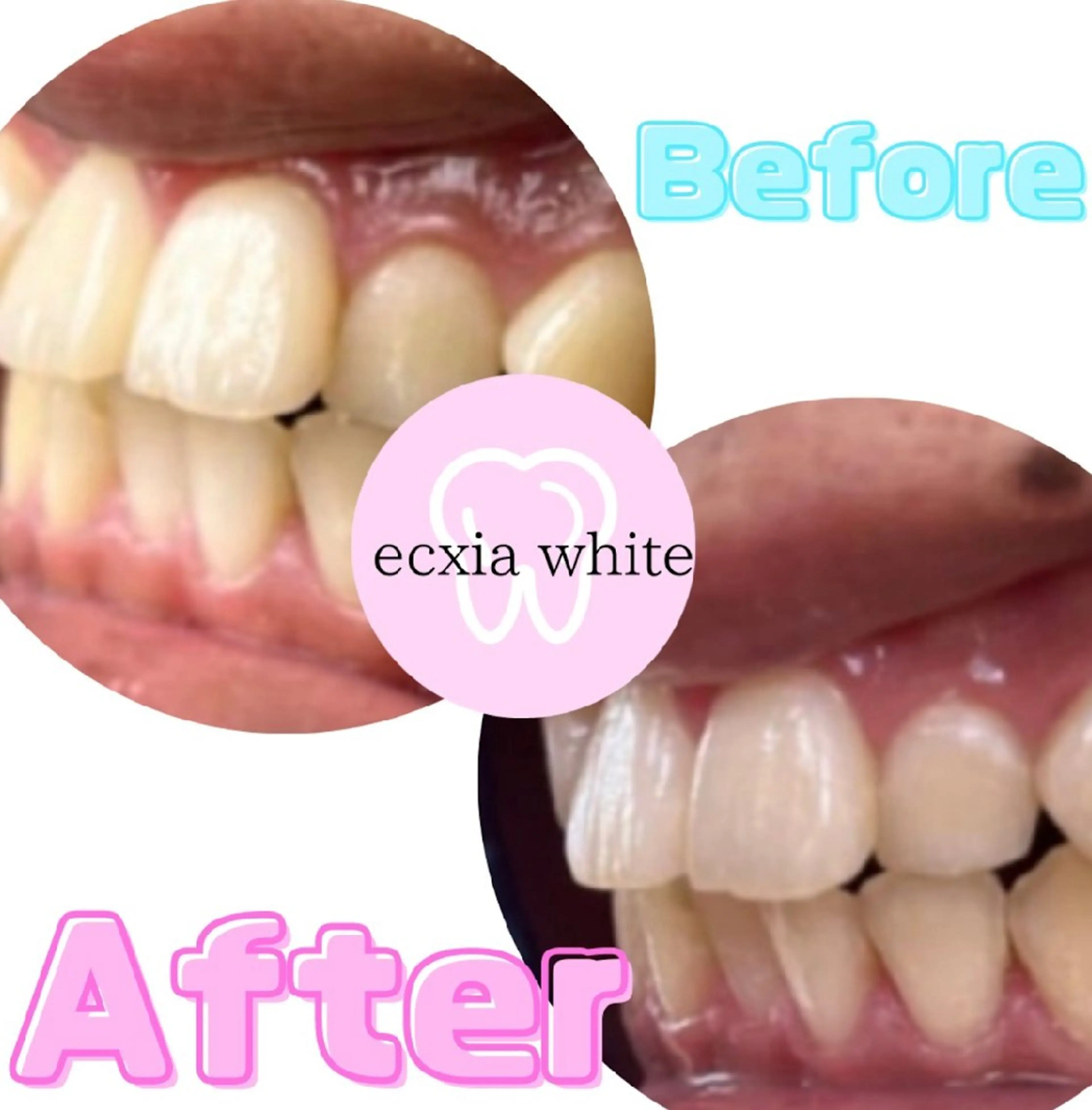 ecxia  white 　広島袋町店所属・セルフホワイトニング エクシア広島袋町店のその他イメージ