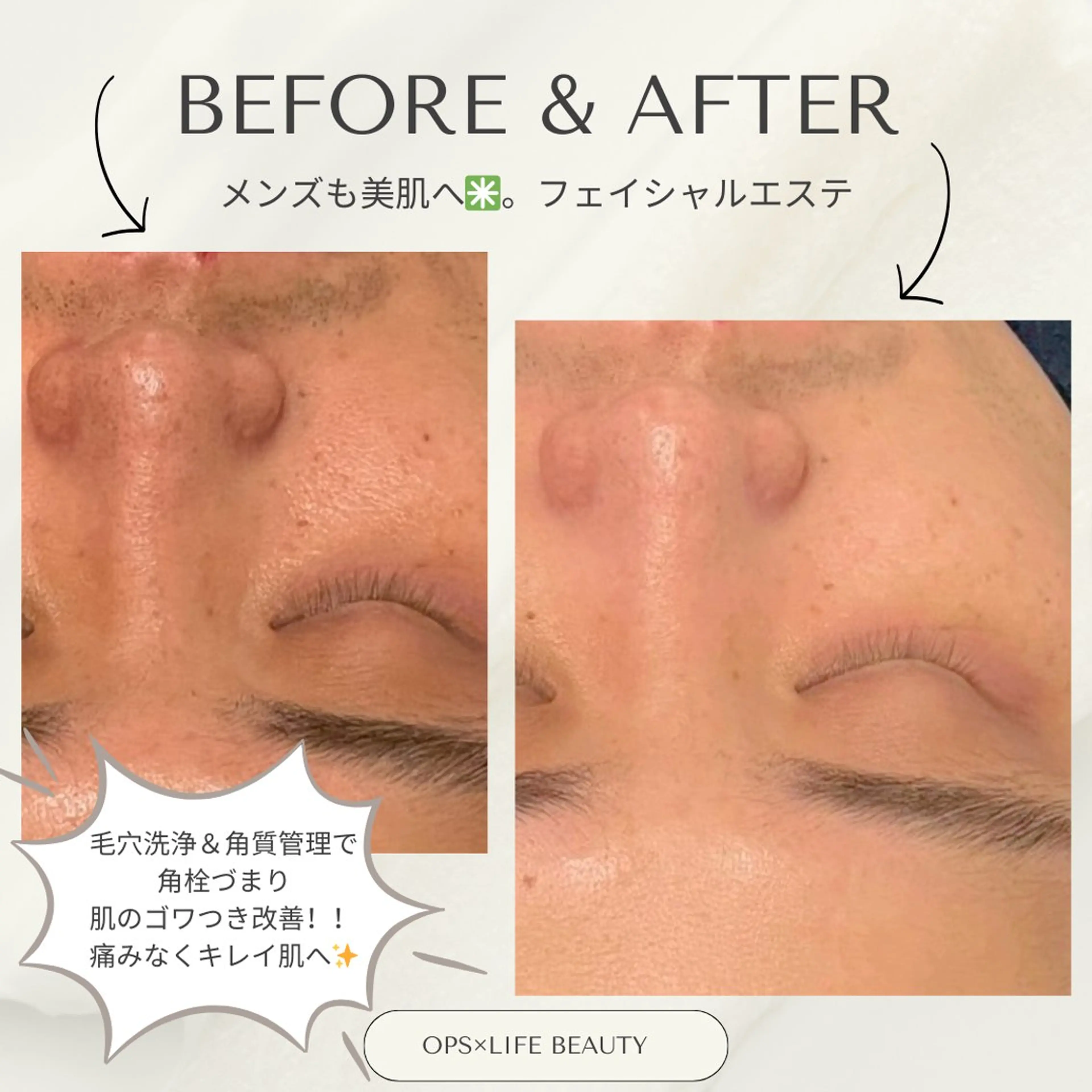 メンズ OPS×LIFE BEAUTY/maiのエステ・リラクイメージ