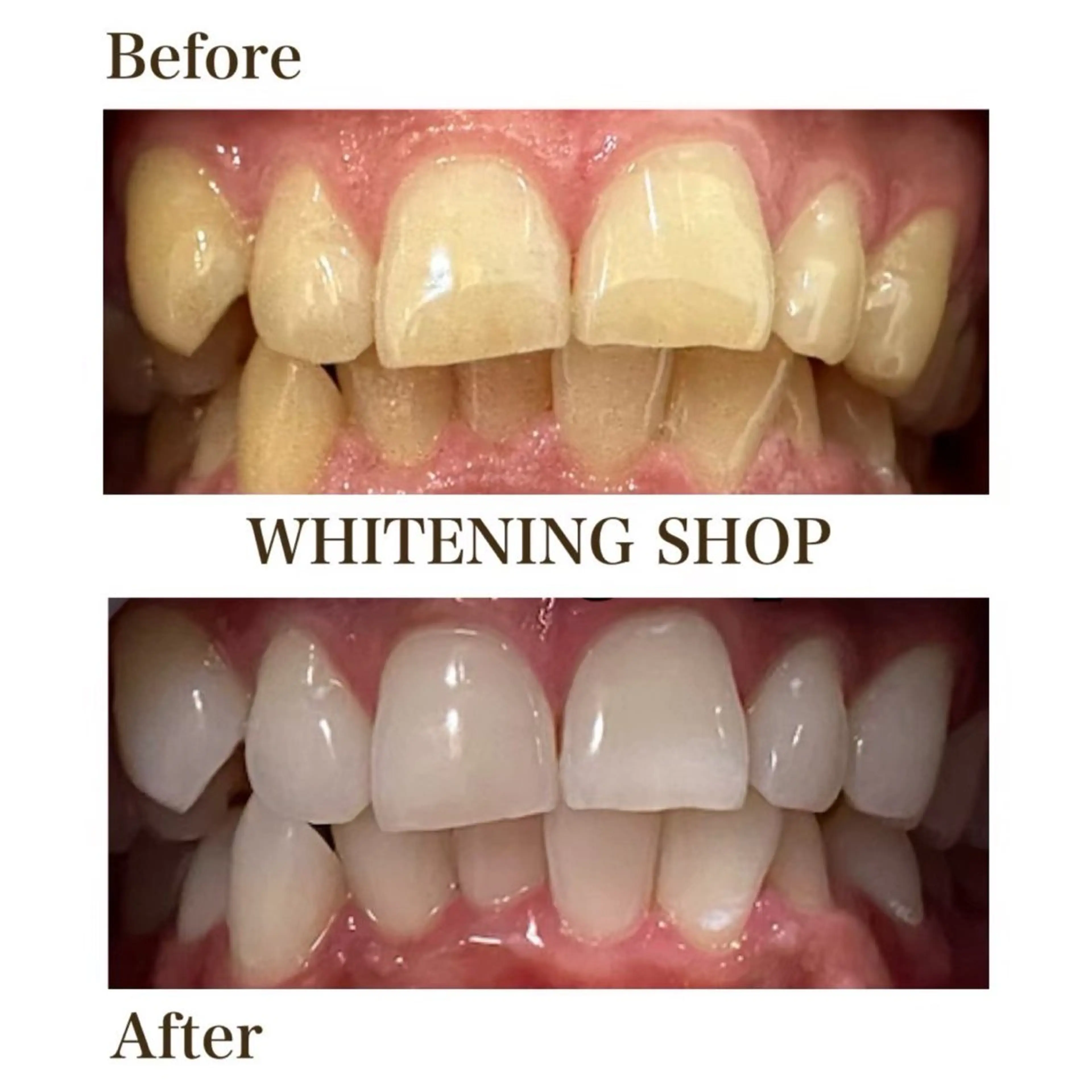 メンズ ホワイトニングショップ静岡葵区店所属・ホワイトニング ショップ葵区静岡駅店のその他イメージ