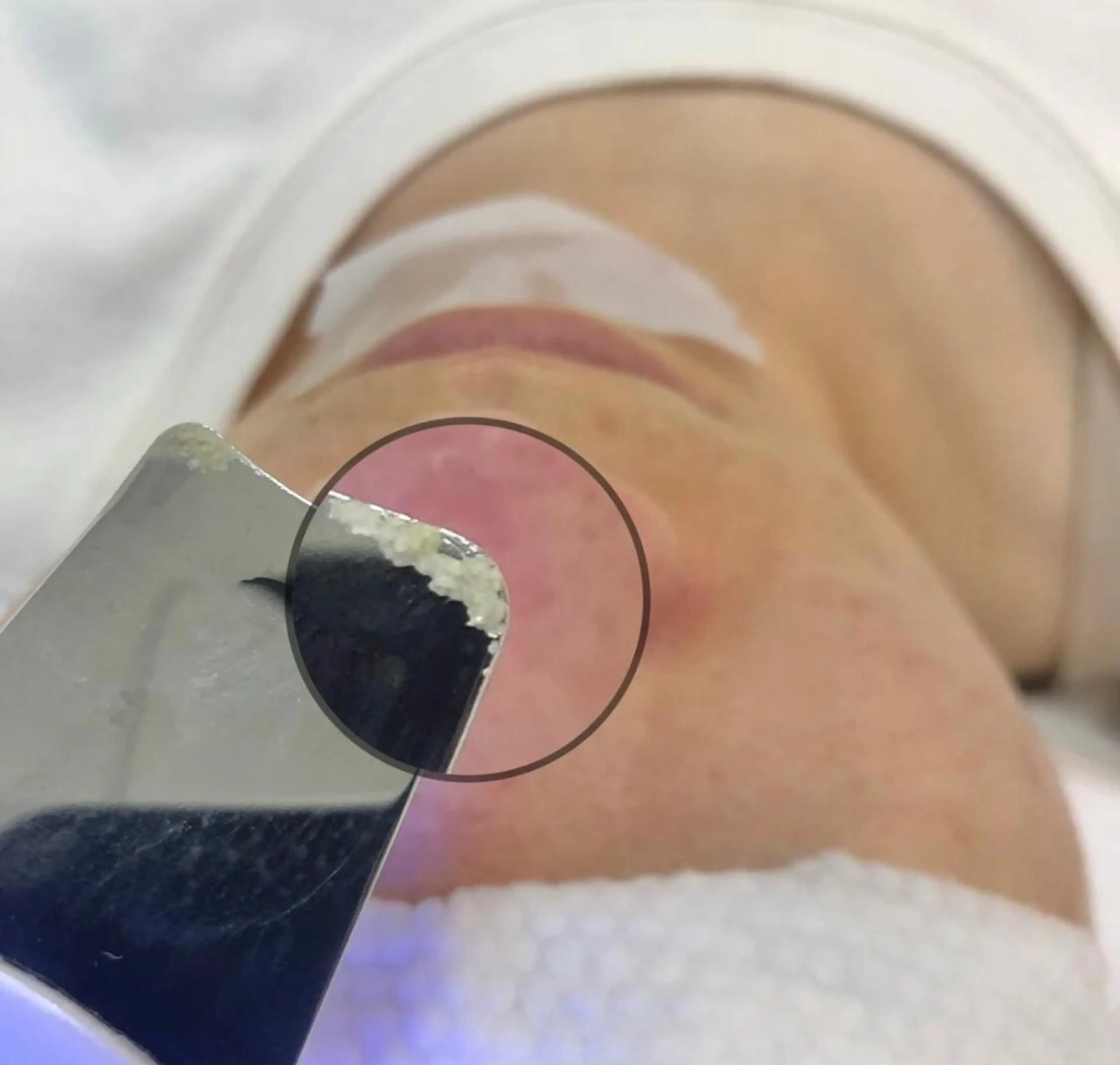 エステ Angela エステサロンのマツエク・マツパデザイン