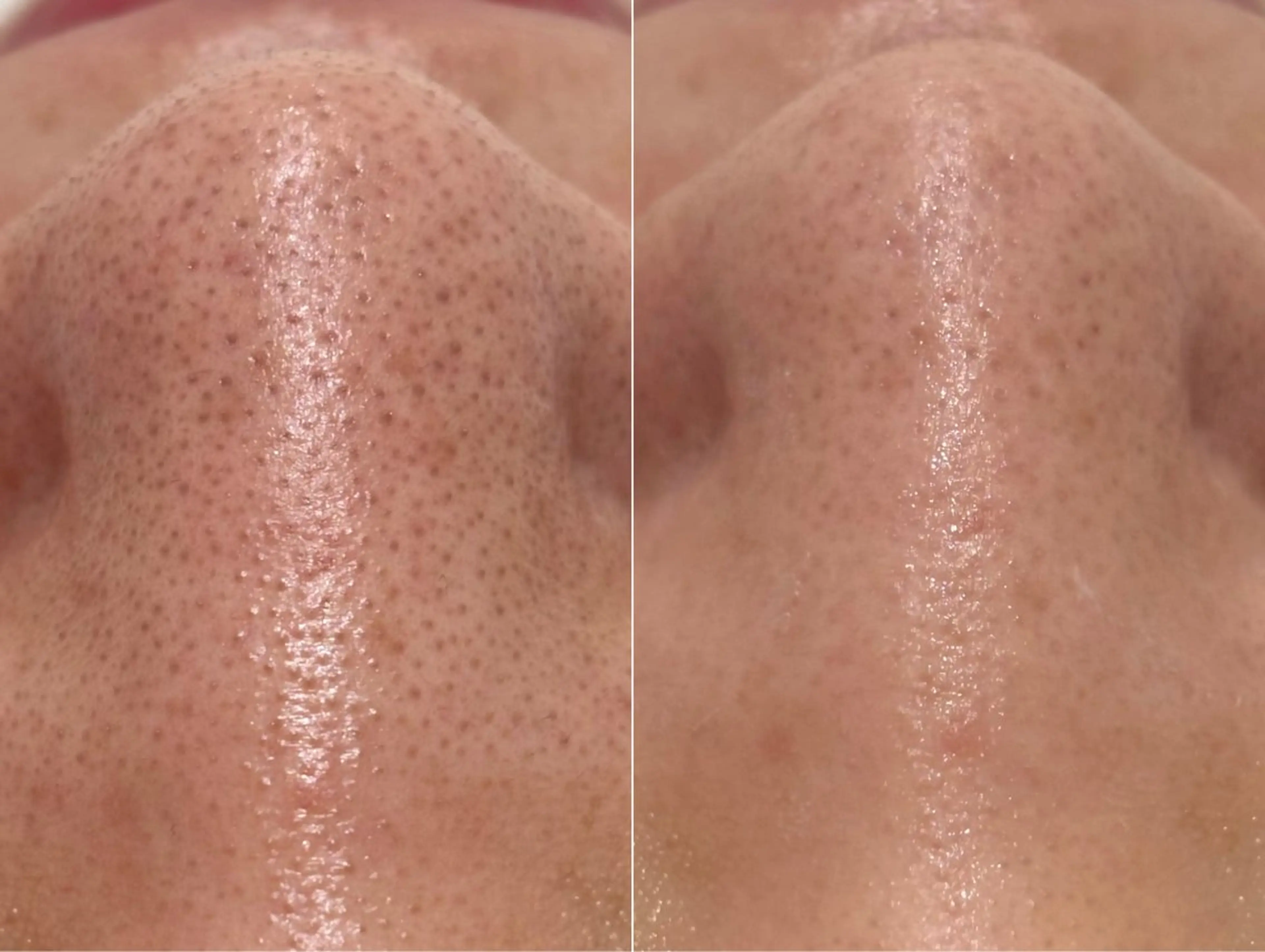 エステ リラク 美の宝石屋さん gemme【ジェム】所属・gemme -ジェム-のエステ・リラクイメージ