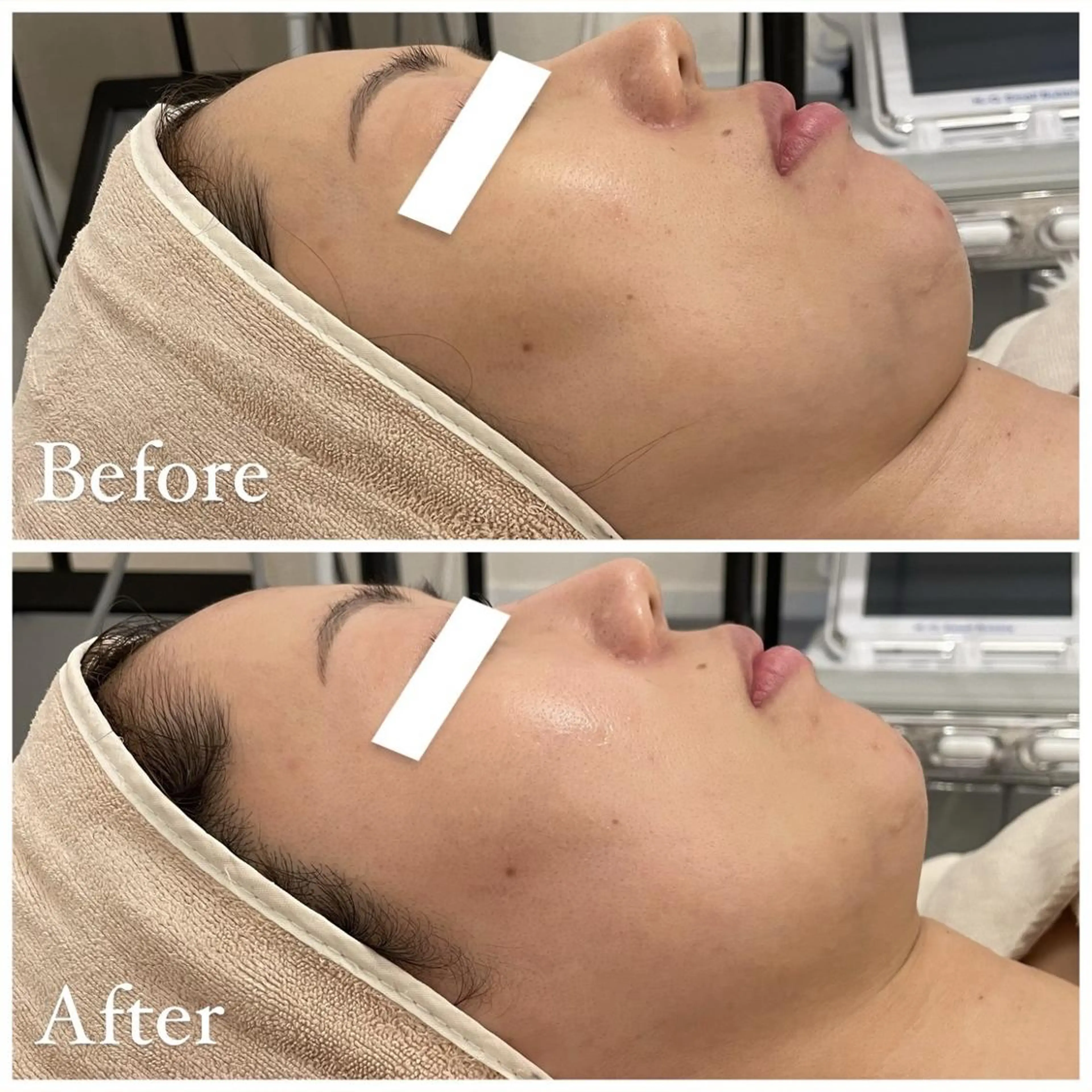 ✨美肌水光✨ アトリエリュバンのエステ・リラクイメージ