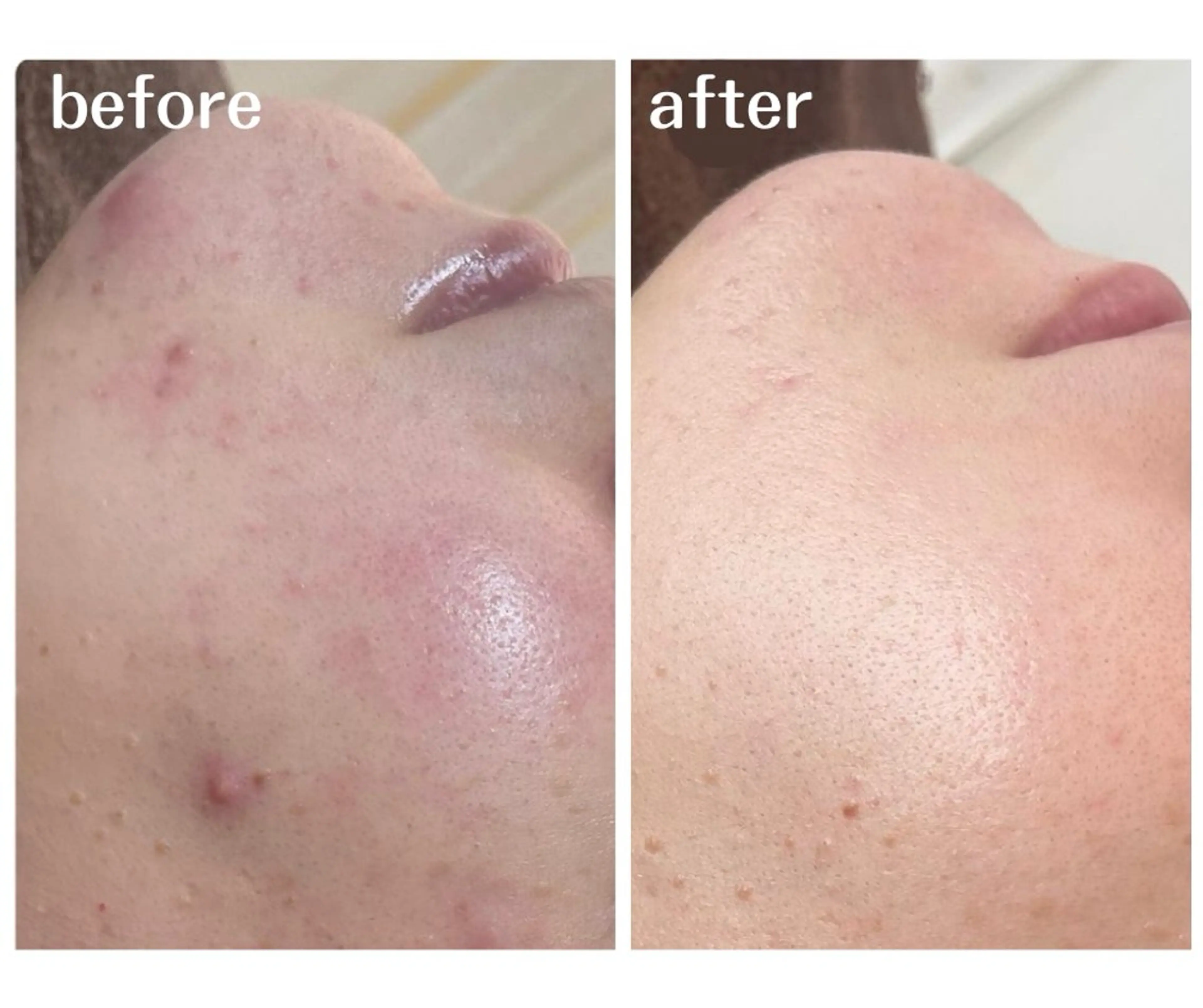 エステ aimee　肌質改善サロン【アイミー】所属・肌質改善サロン aimee｜アイミーのエステ・リラクイメージ