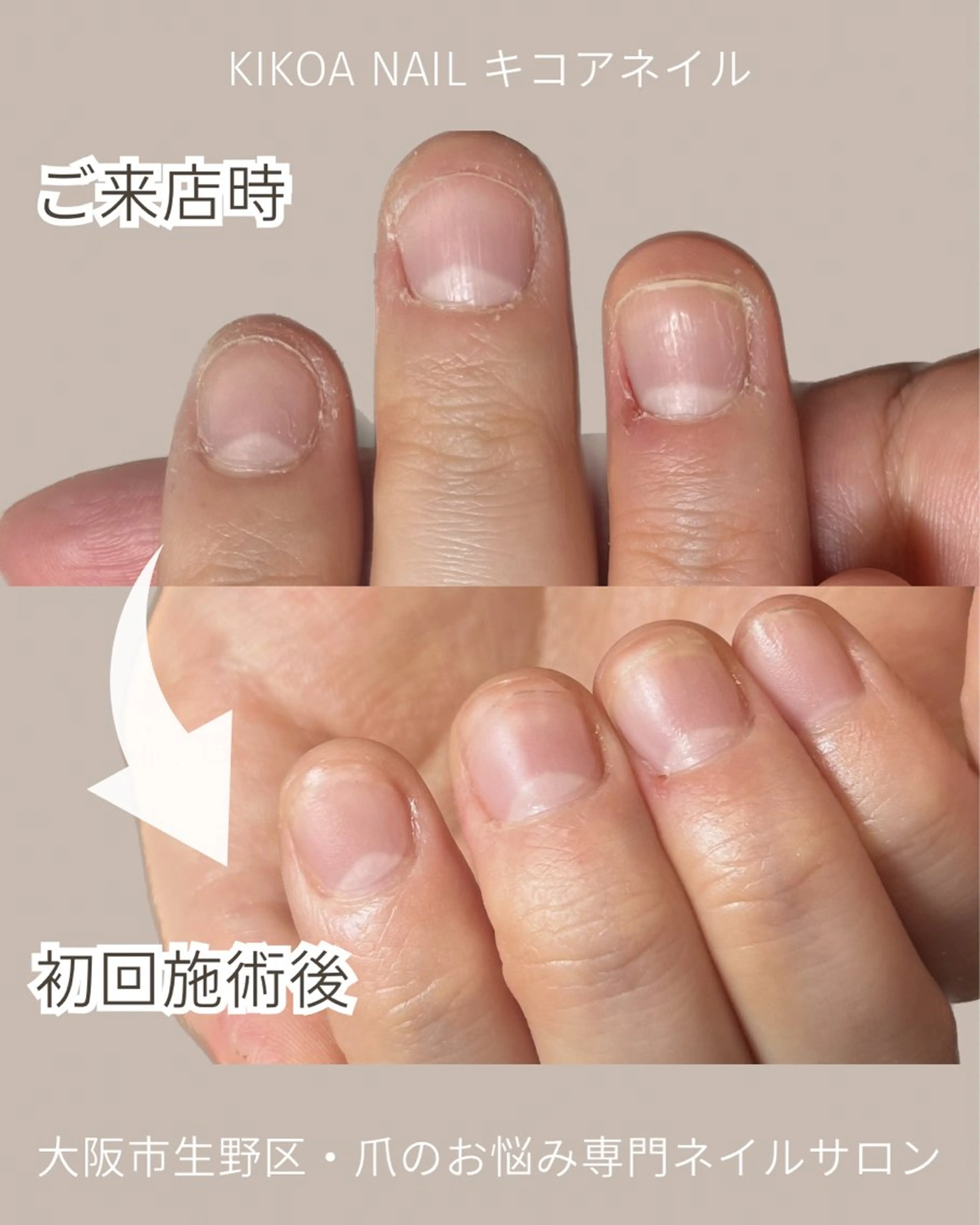 ネイル メンズネイル KIKOA NAIL キコアネイルのネイルデザイン