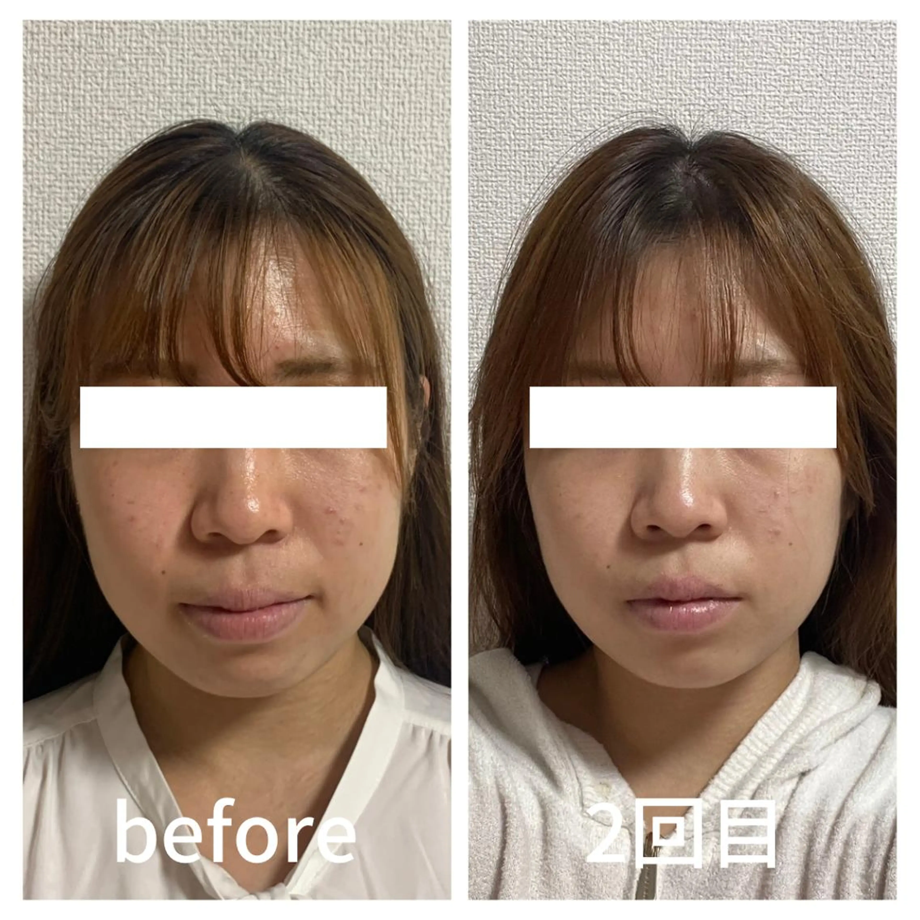 小顔サロン AMYONのエステ・リラクイメージ