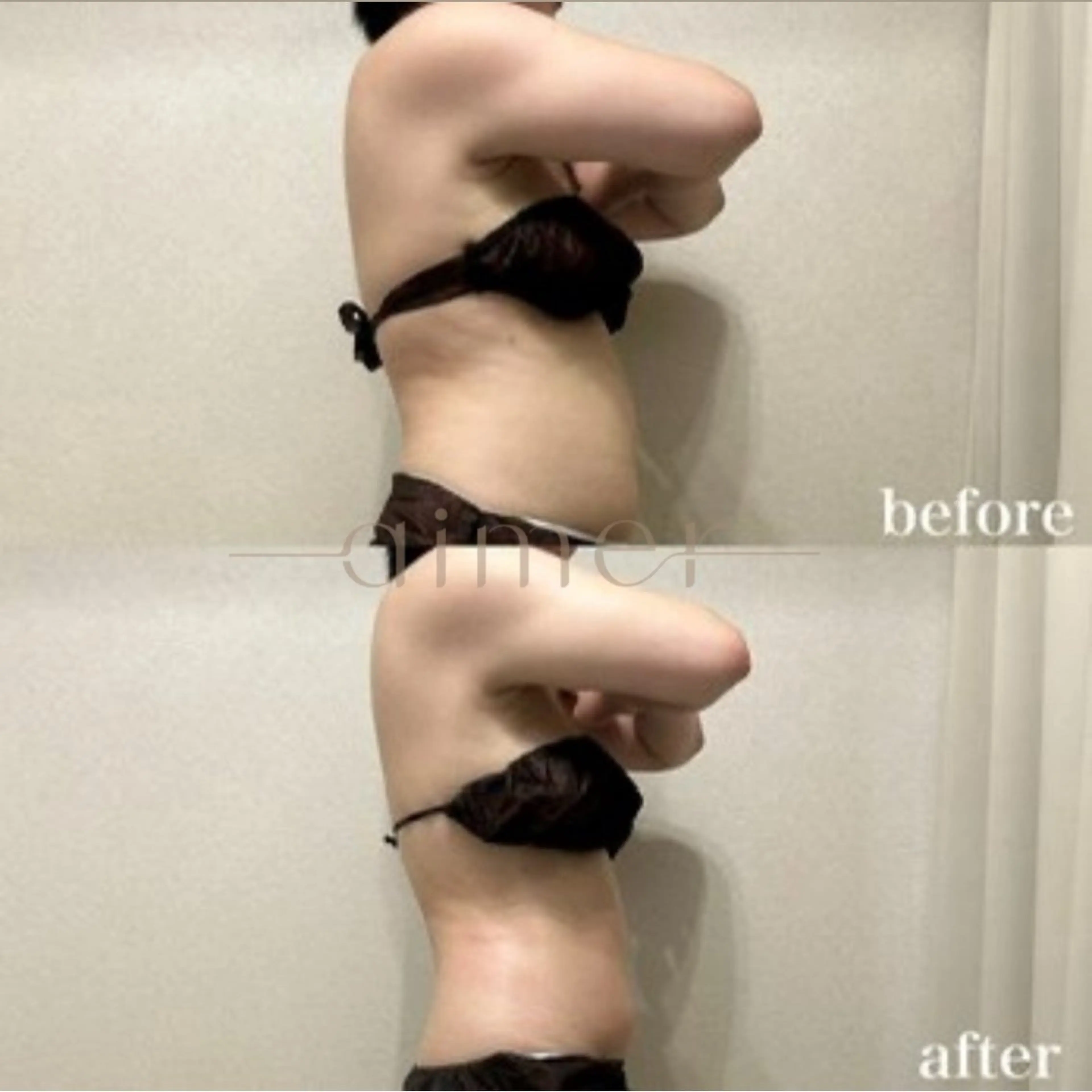 🍋ハイパーナイフ×レモン_ボトル_2cc🍋｜ボディライン｜の写真