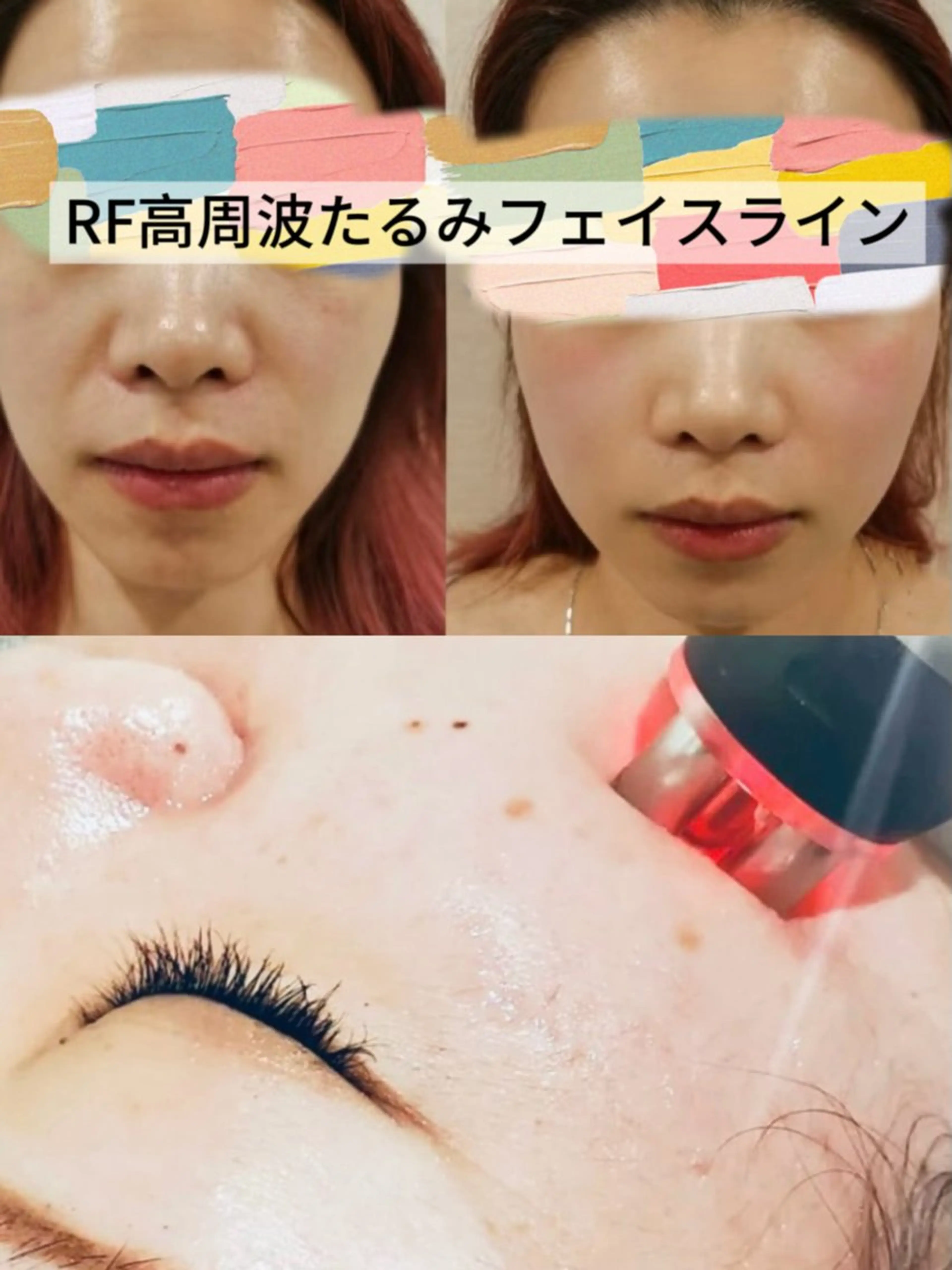 美BELLO 池袋のエステ・リラクイメージ