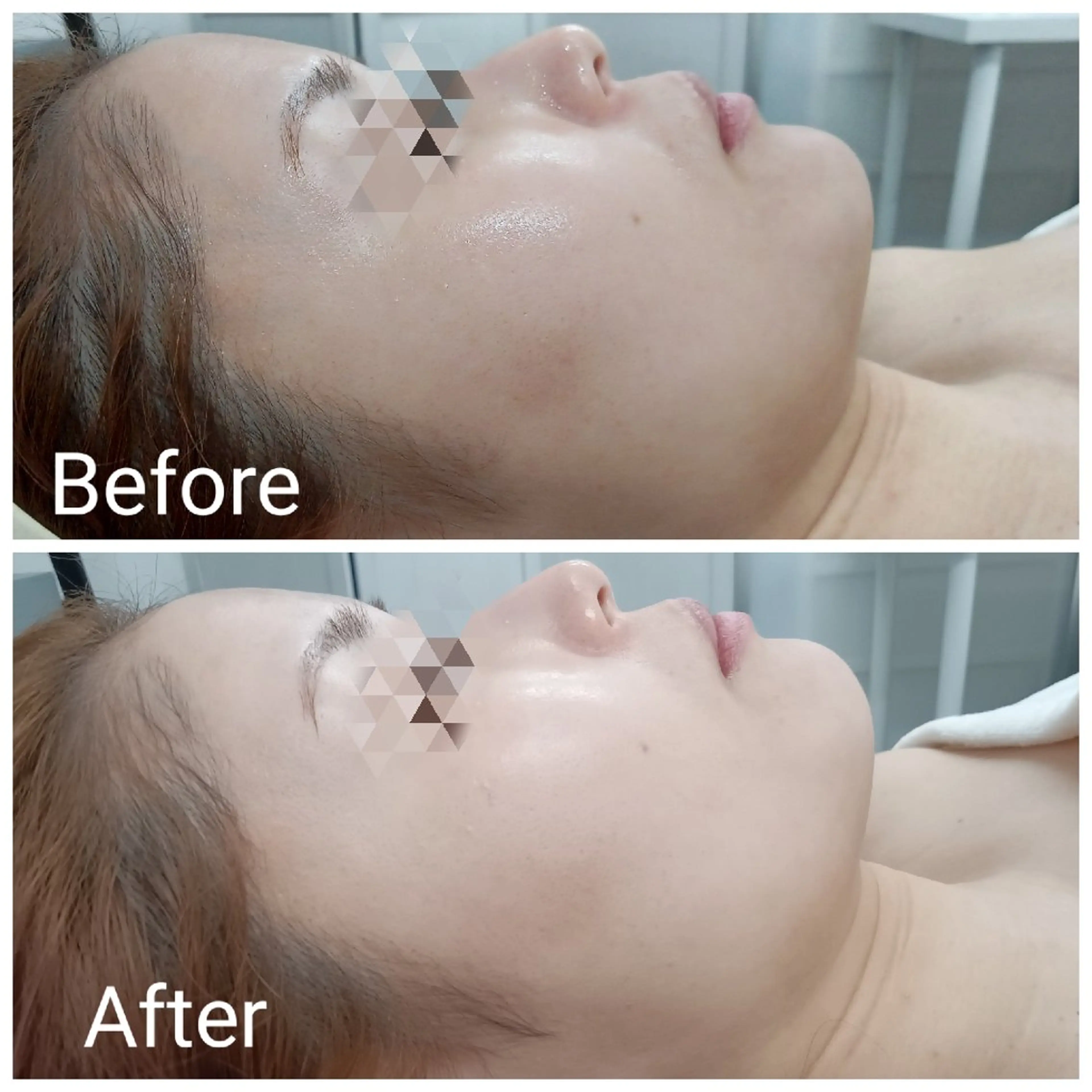 エステ リラク 肌質改善Beauty salon Renのエステ・リラクイメージ