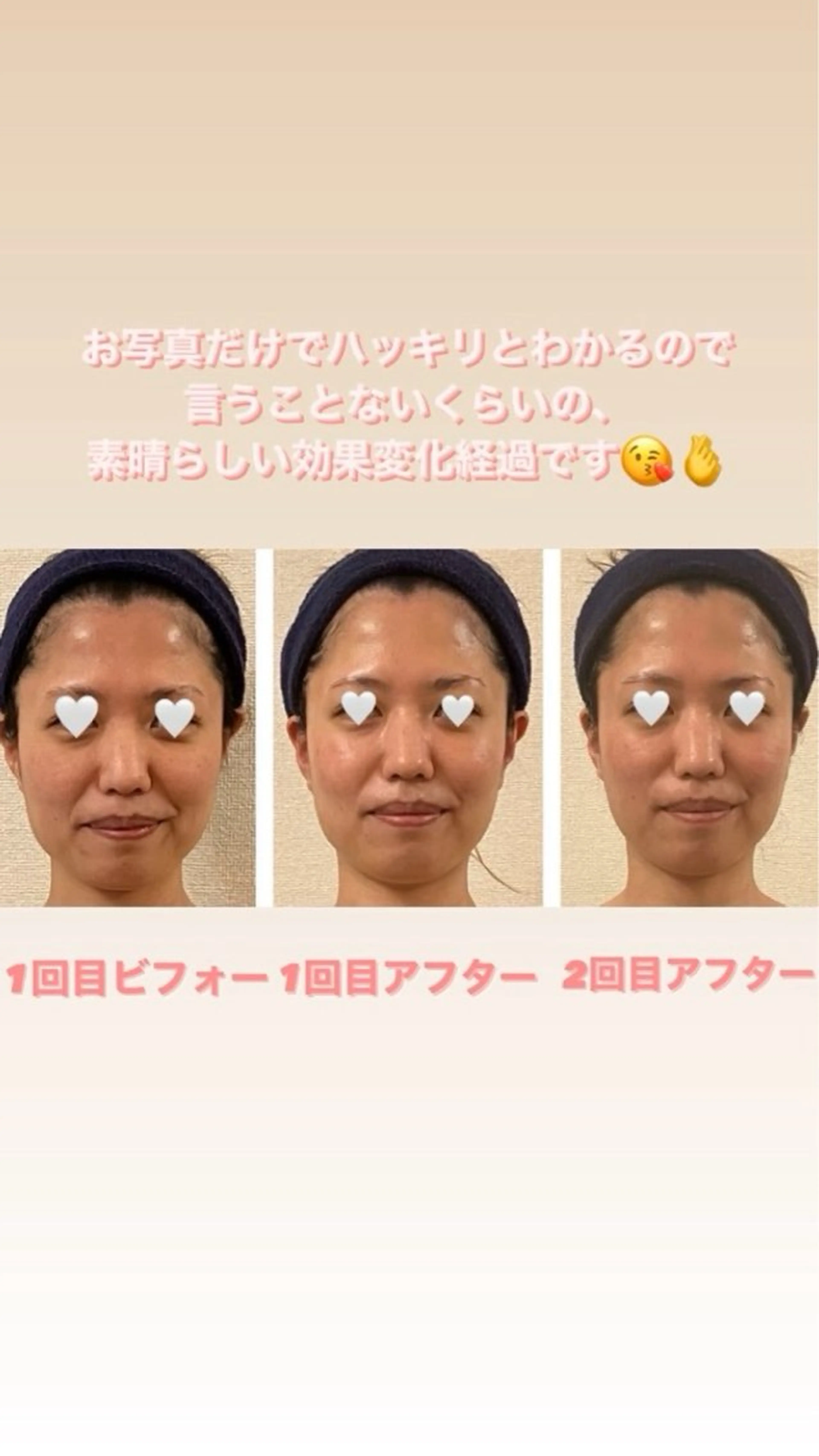 コルギサロンHonon所属・コルギサロン Hononのエステ・リラクイメージ