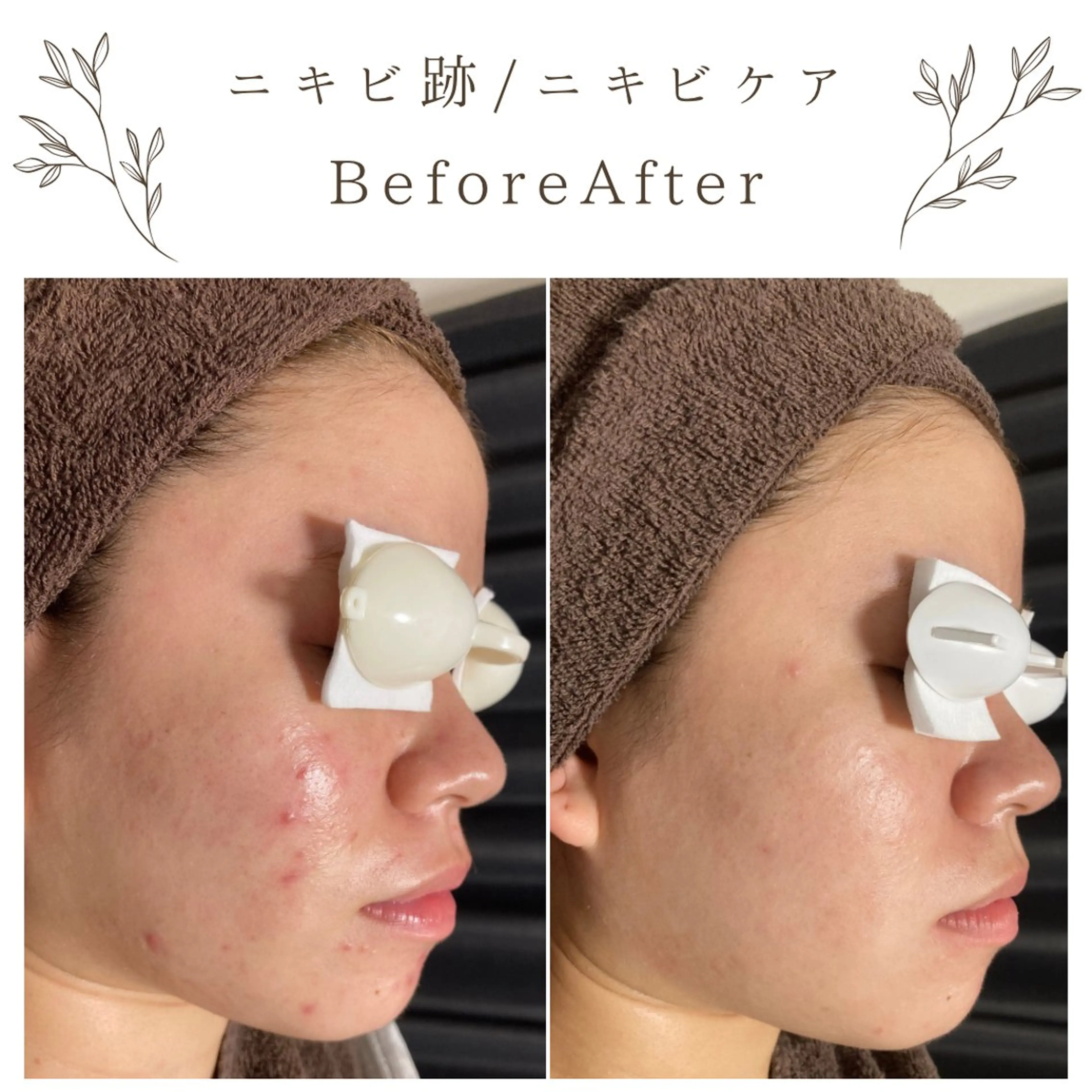 な ぎのエステ・リラクイメージ