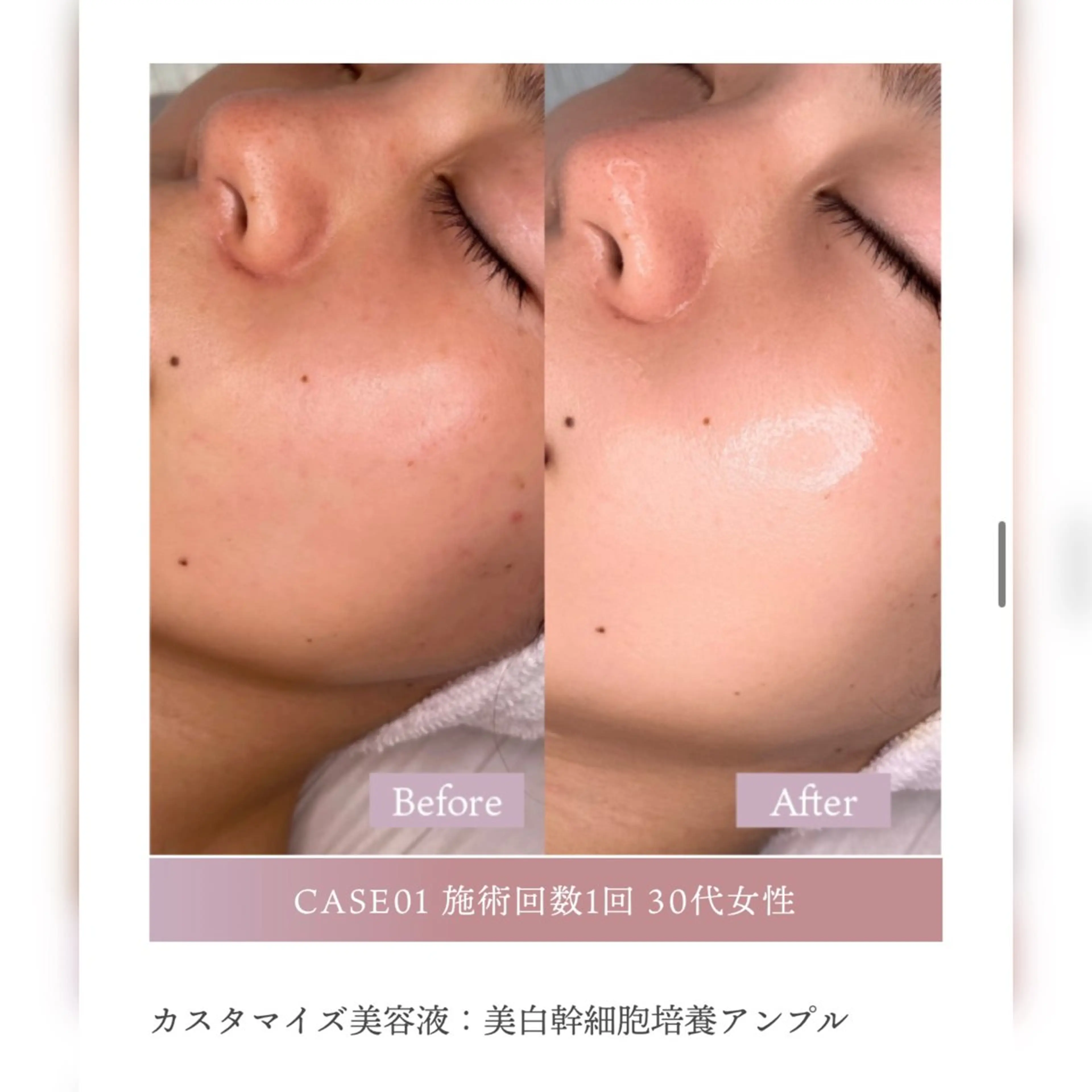 韓国美容🇰🇷 creana🌿のエステ・リラクイメージ