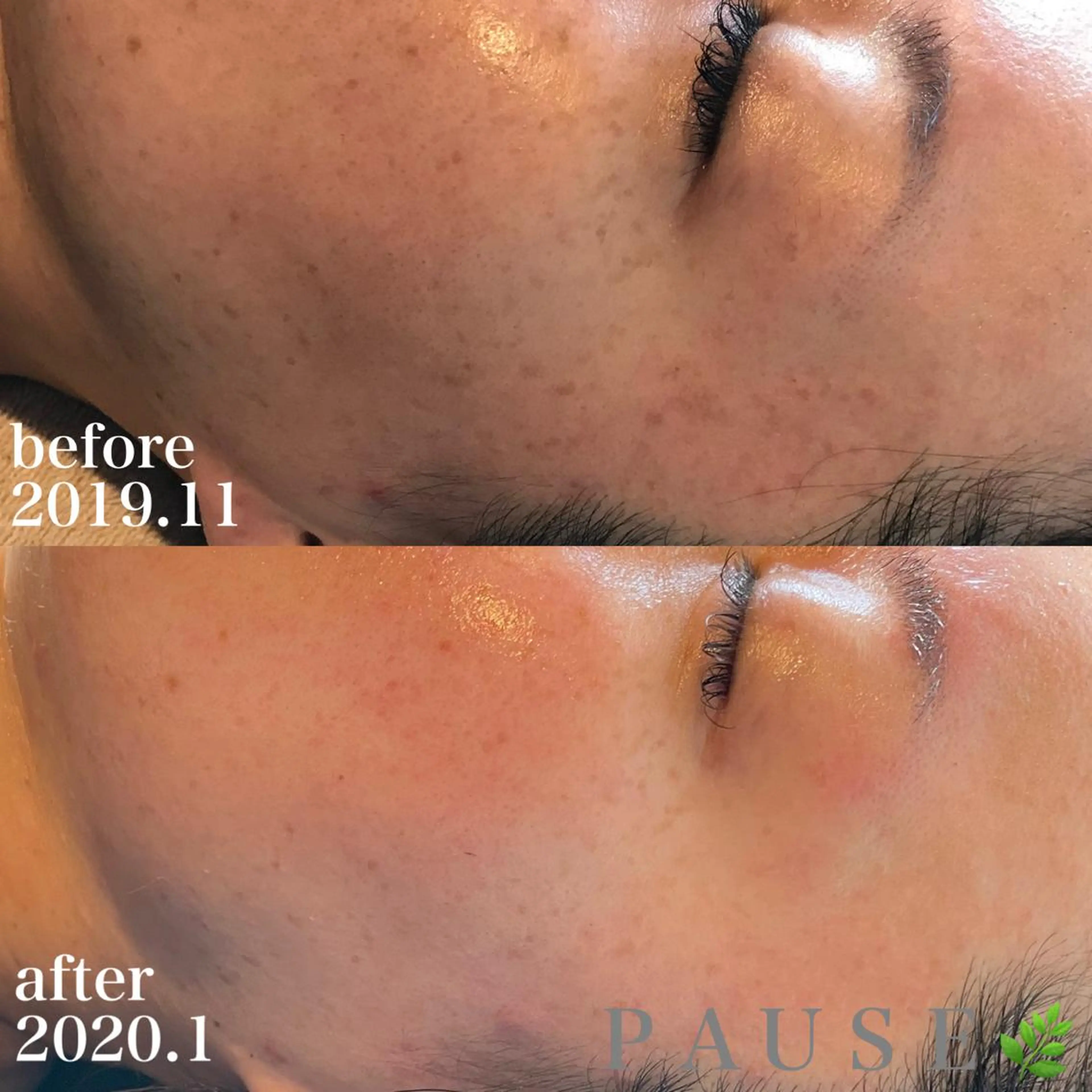 エステ 浜野 恵美のエステ・リラクイメージ