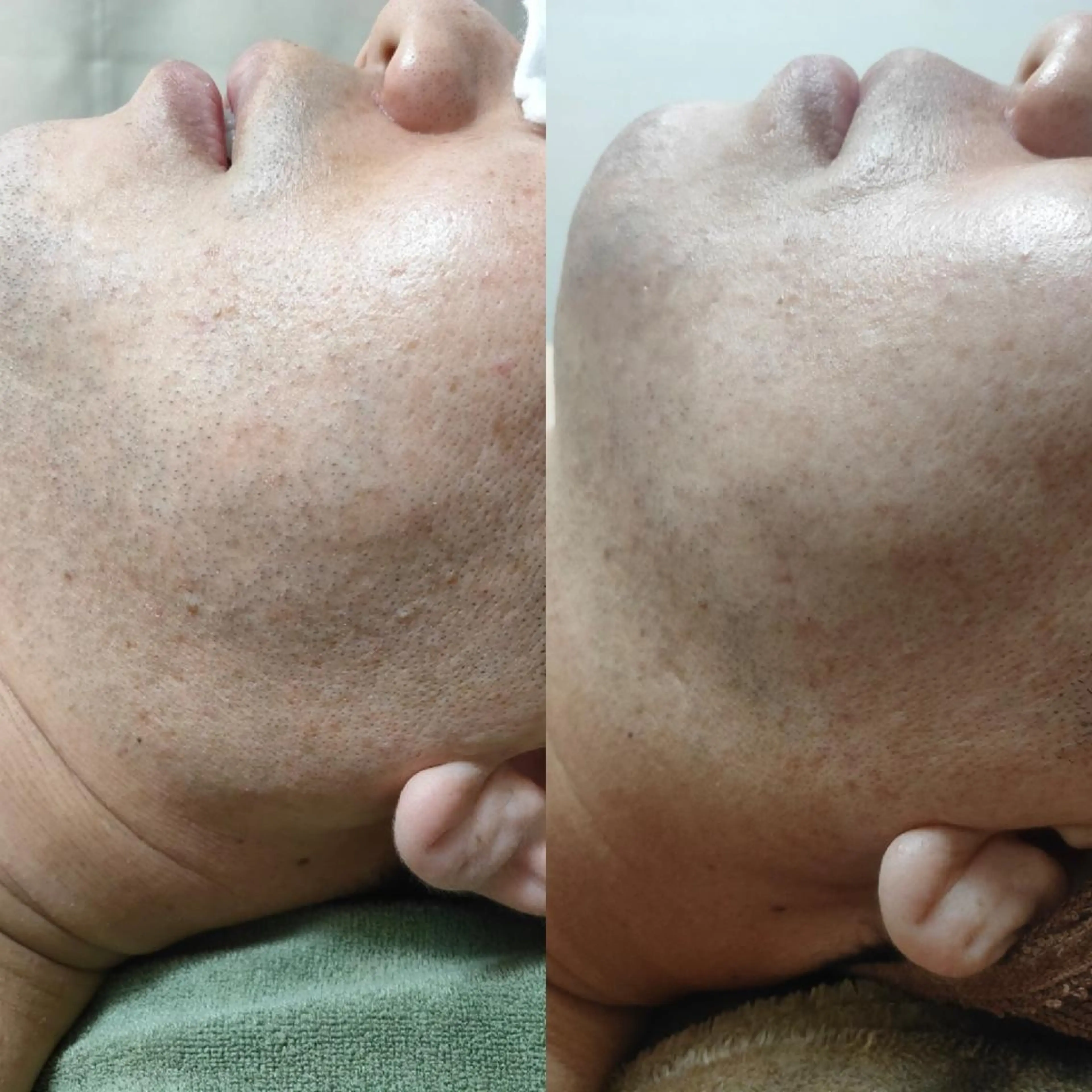 メンズ 武 藤のエステ・リラクイメージ