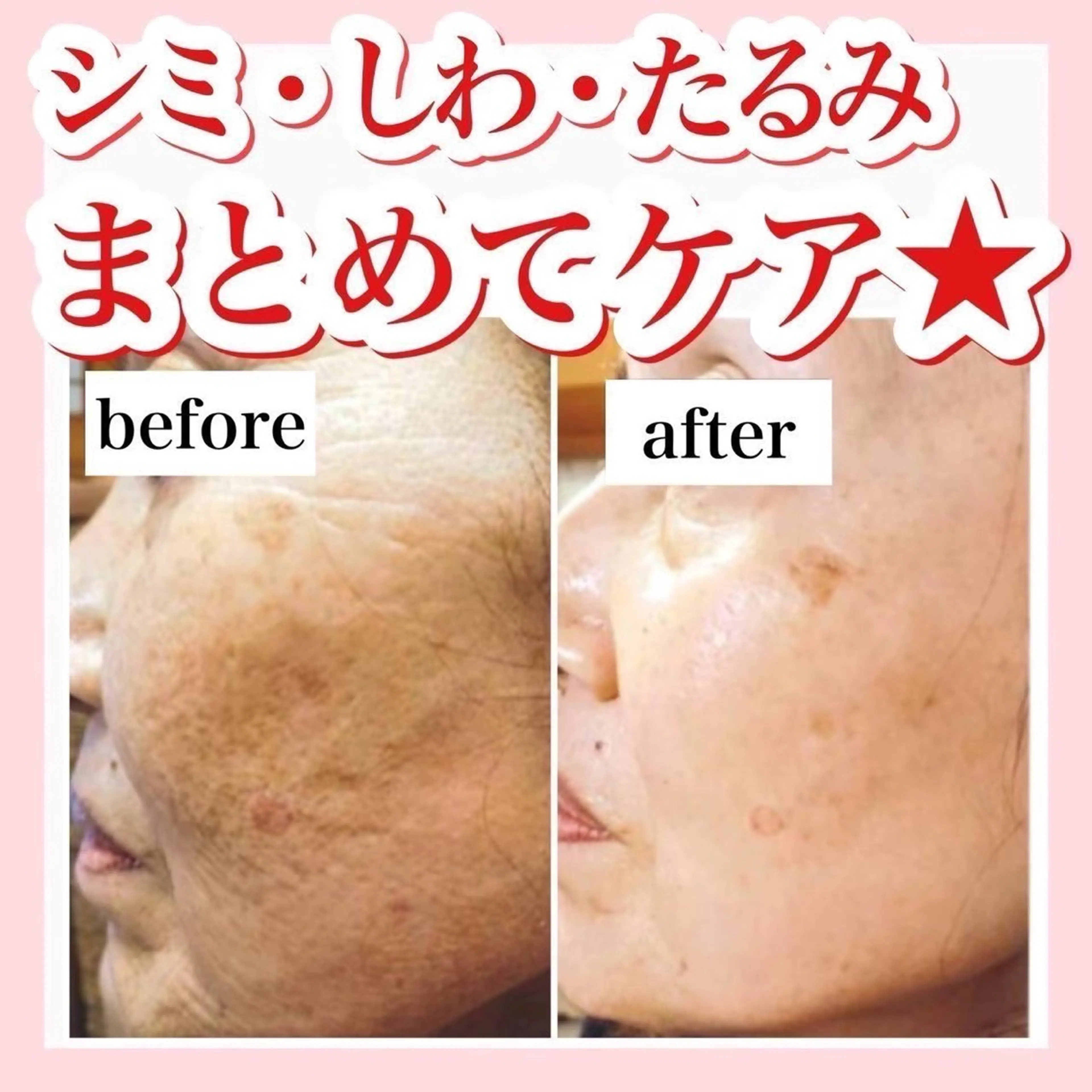 ハーブピーリング/ ララピール専門店のエステ・リラクイメージ