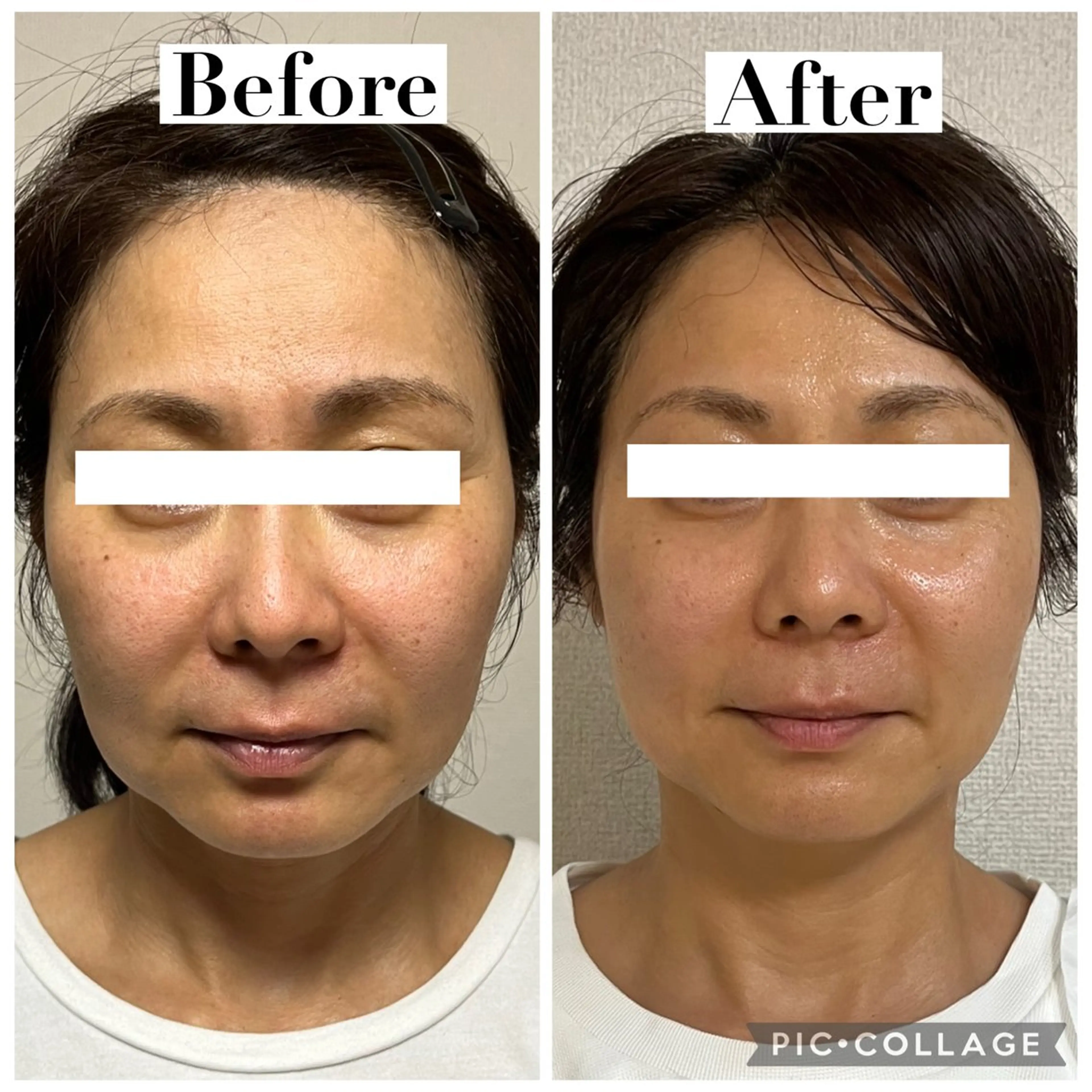 エステ リラク たるみ改善サロン Ｍdesignのエステ・リラクイメージ