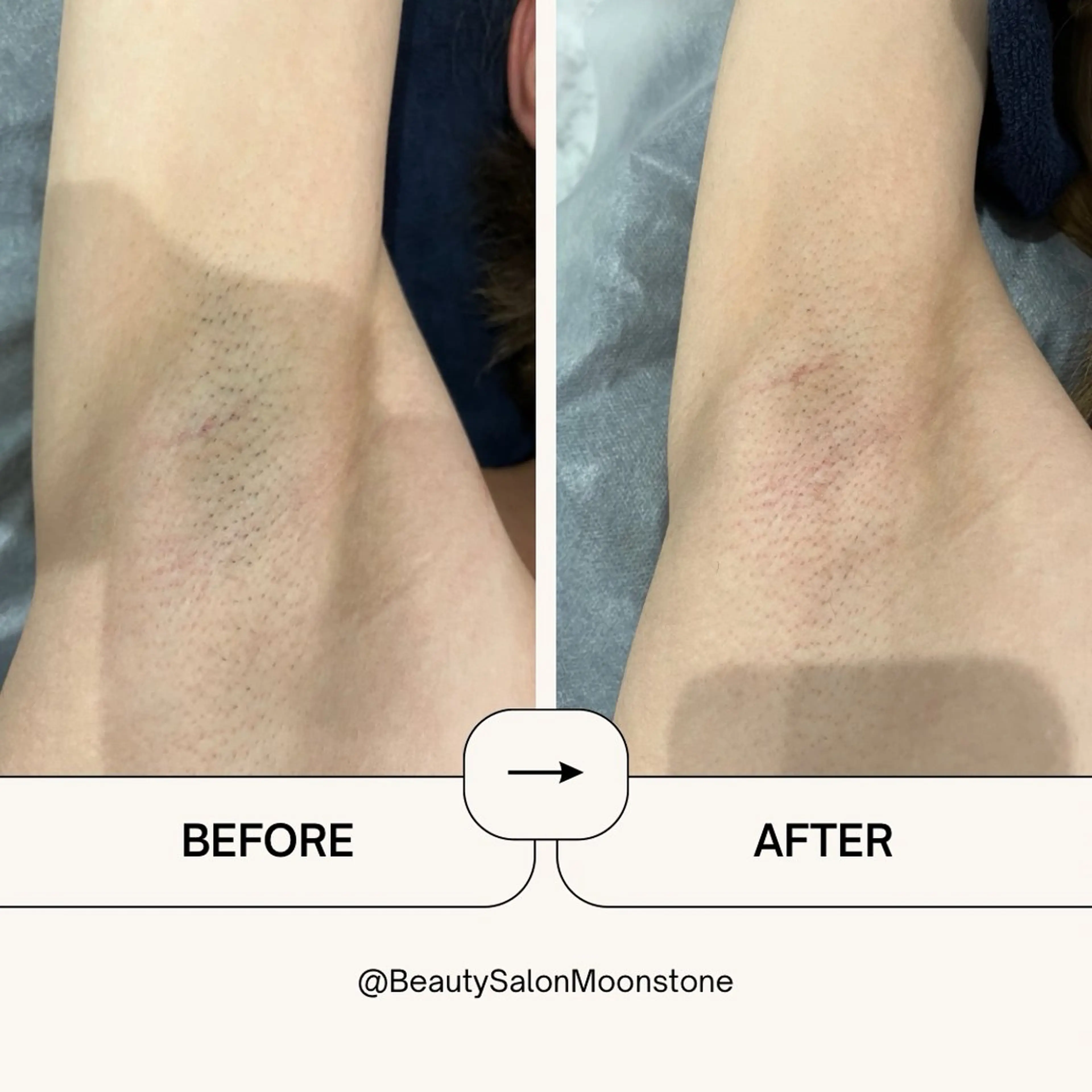 Beauty Salon Moonstone所属・Moonstone 男女•キッズ脱毛のエステ・リラクイメージ