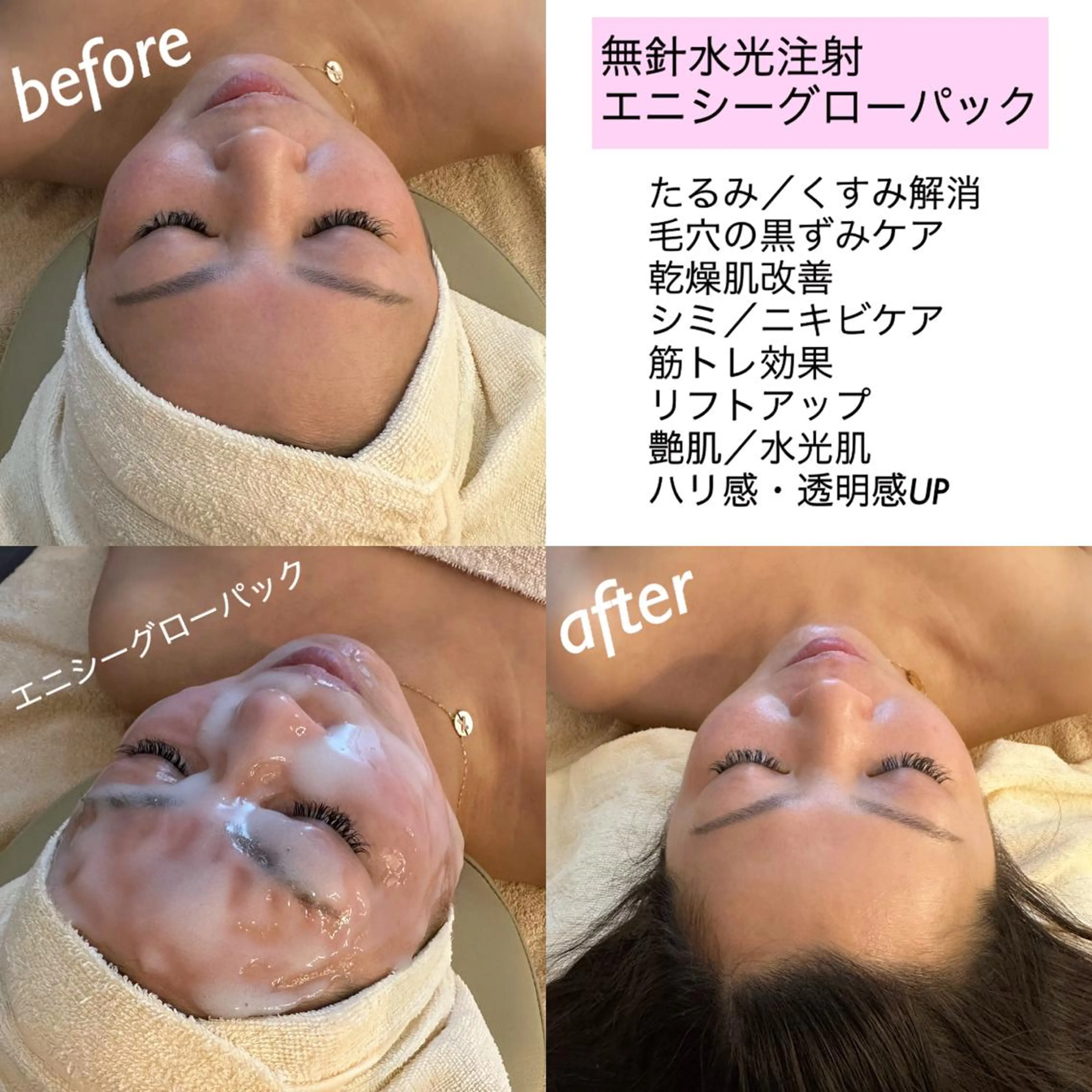 うなじ脱毛/美肌脱毛 LABELのエステ・リラクイメージ