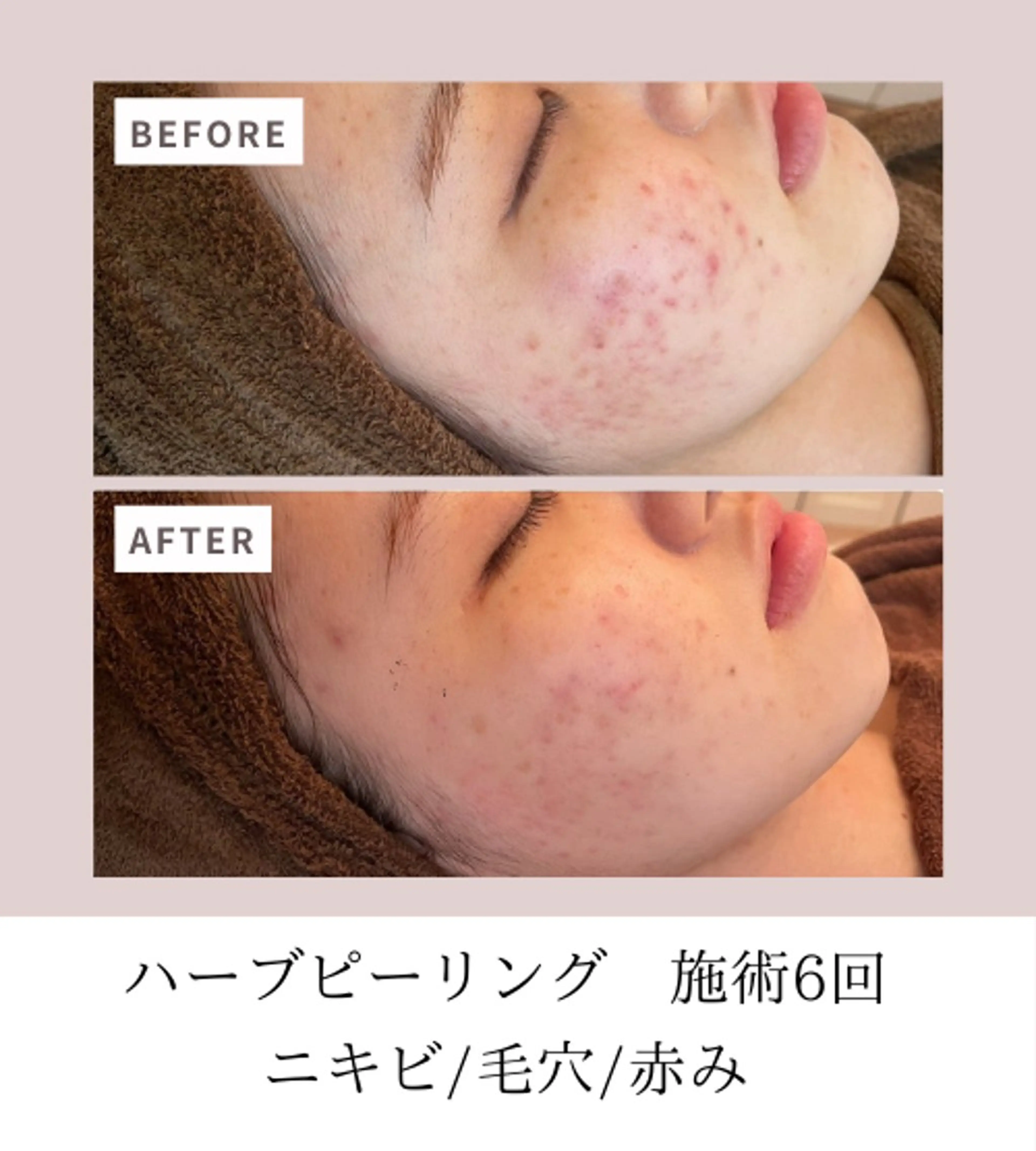 Men's Lab所属・武田 麻里のエステ・リラクイメージ