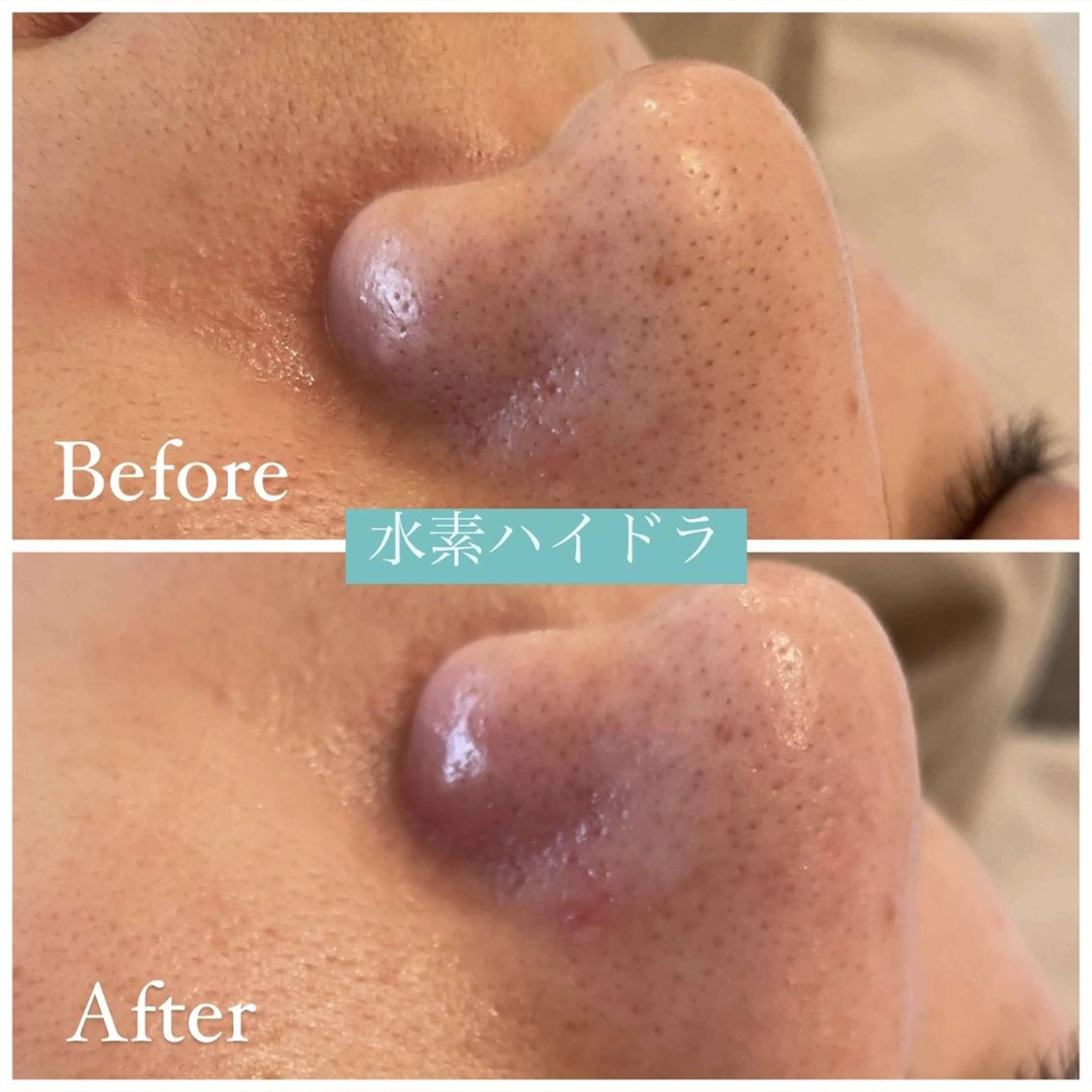 ✨美肌水光✨ アトリエリュバンのエステ・リラクイメージ