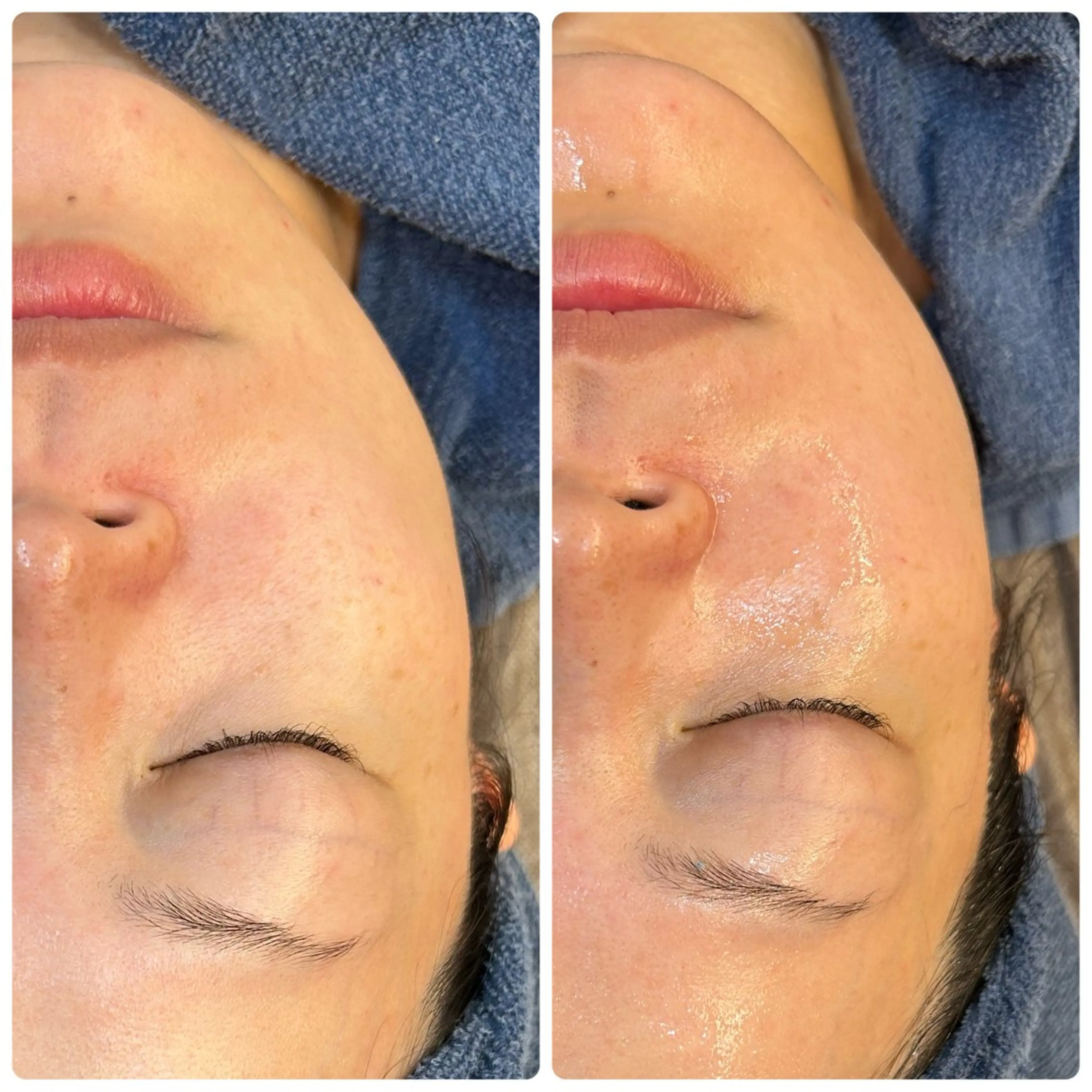 leolo武蔵浦和 肌質改善＆脱毛のエステ・リラクイメージ