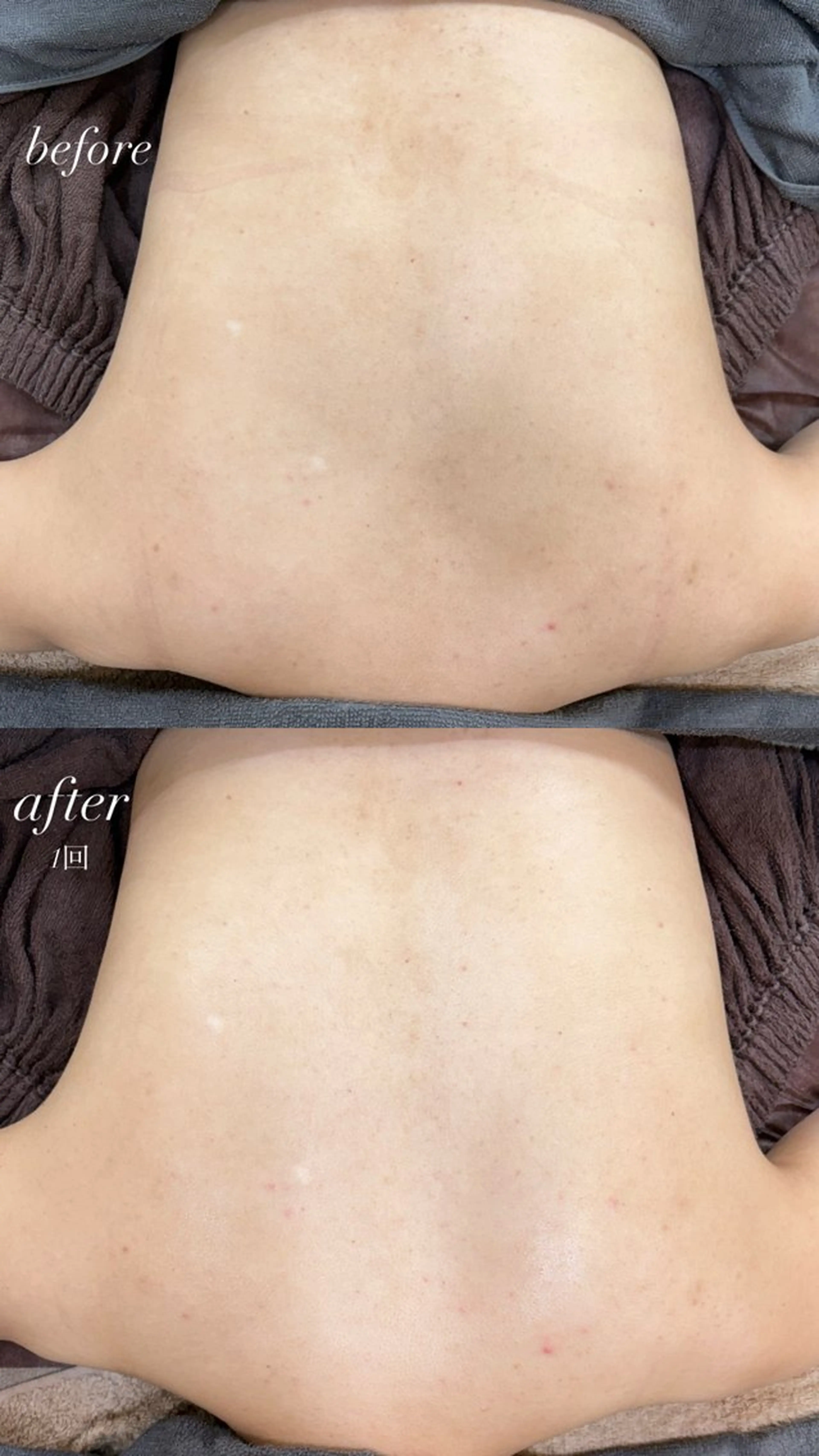 エステ foi🌿 Samiraのエステ・リラクイメージ