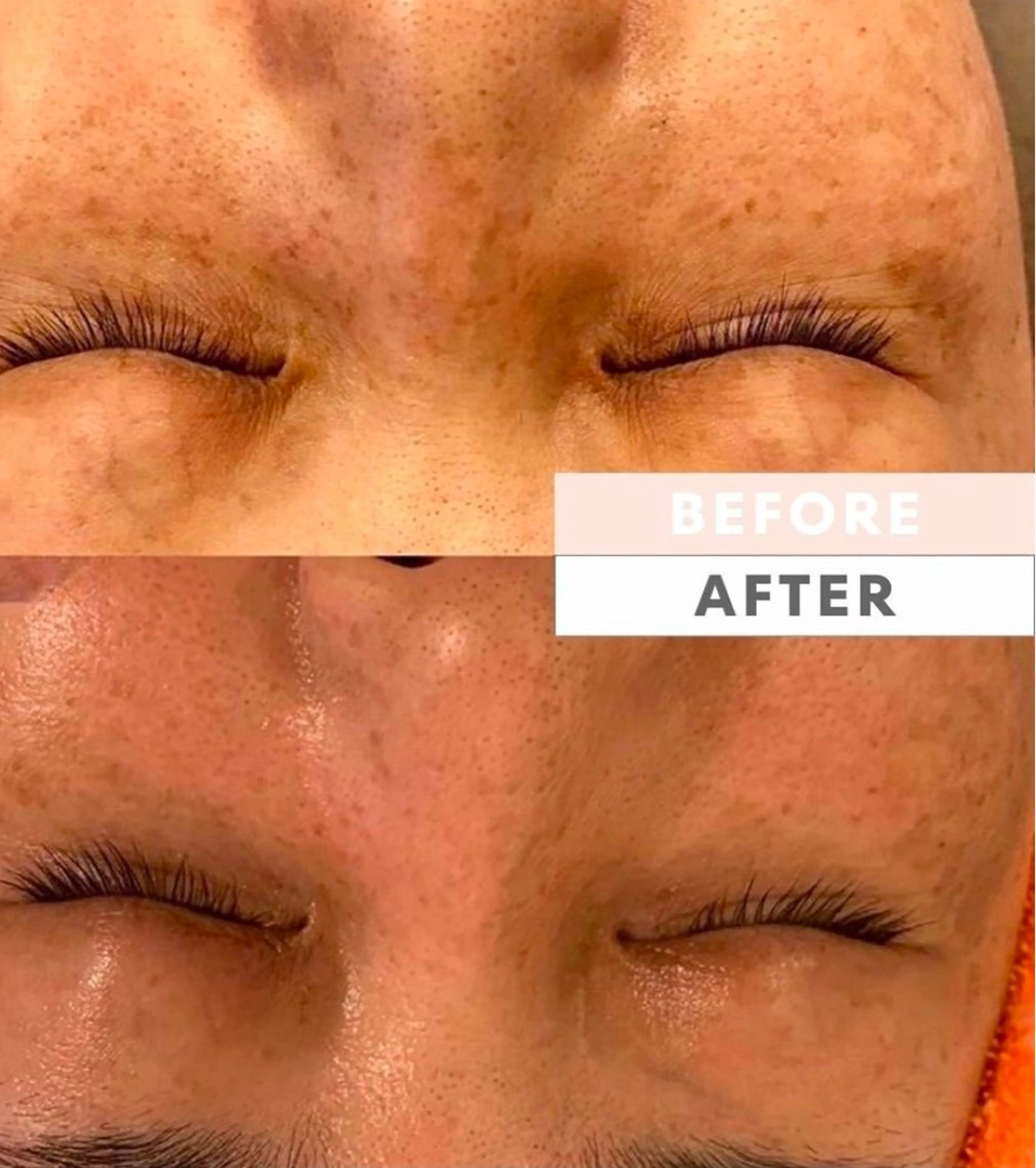 M.plus所属・水光韓国肌ハーブ ピーリングMplusのエステ・リラクイメージ