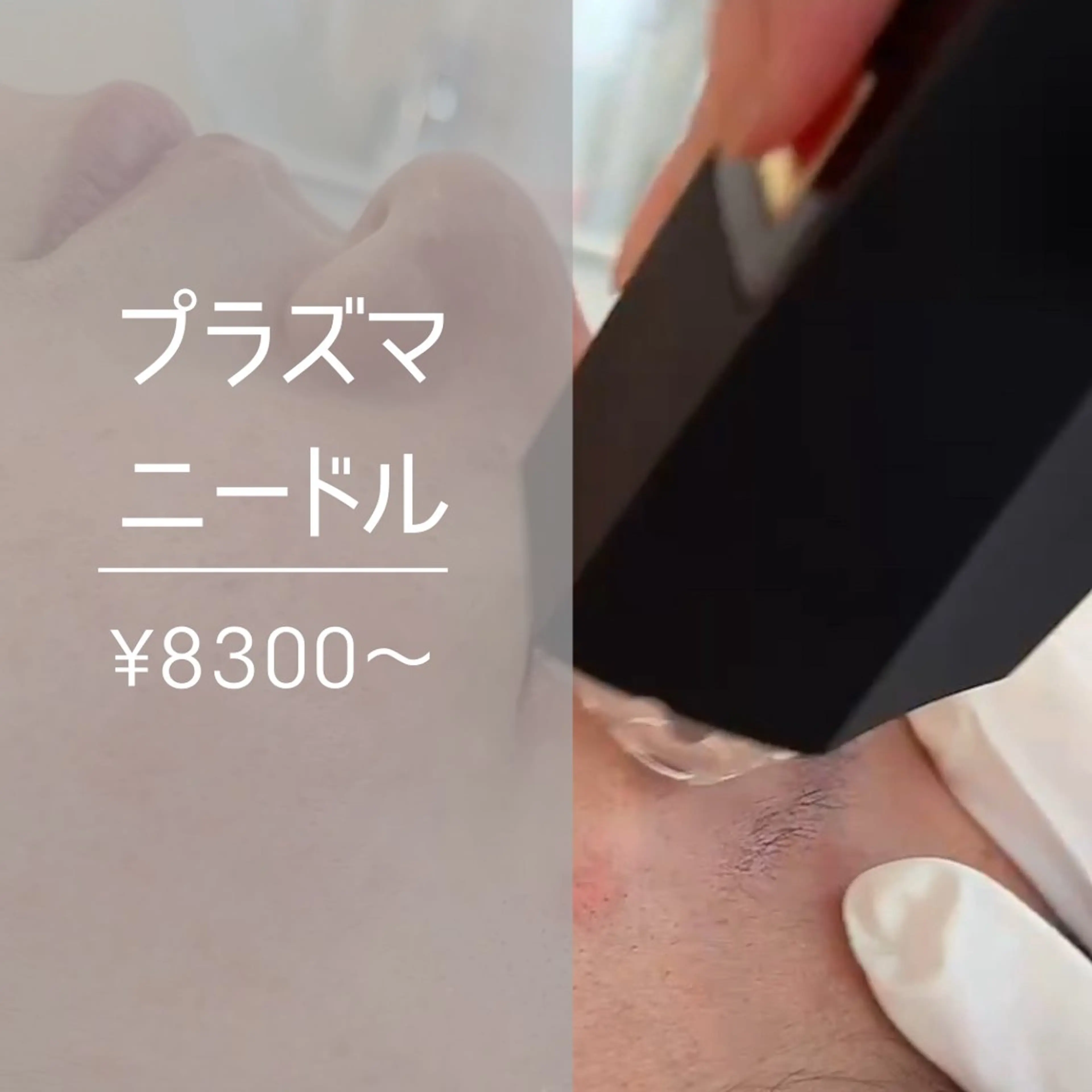 Bright所属・Brightブライト (エステ.リラク)のエステ・リラクイメージ