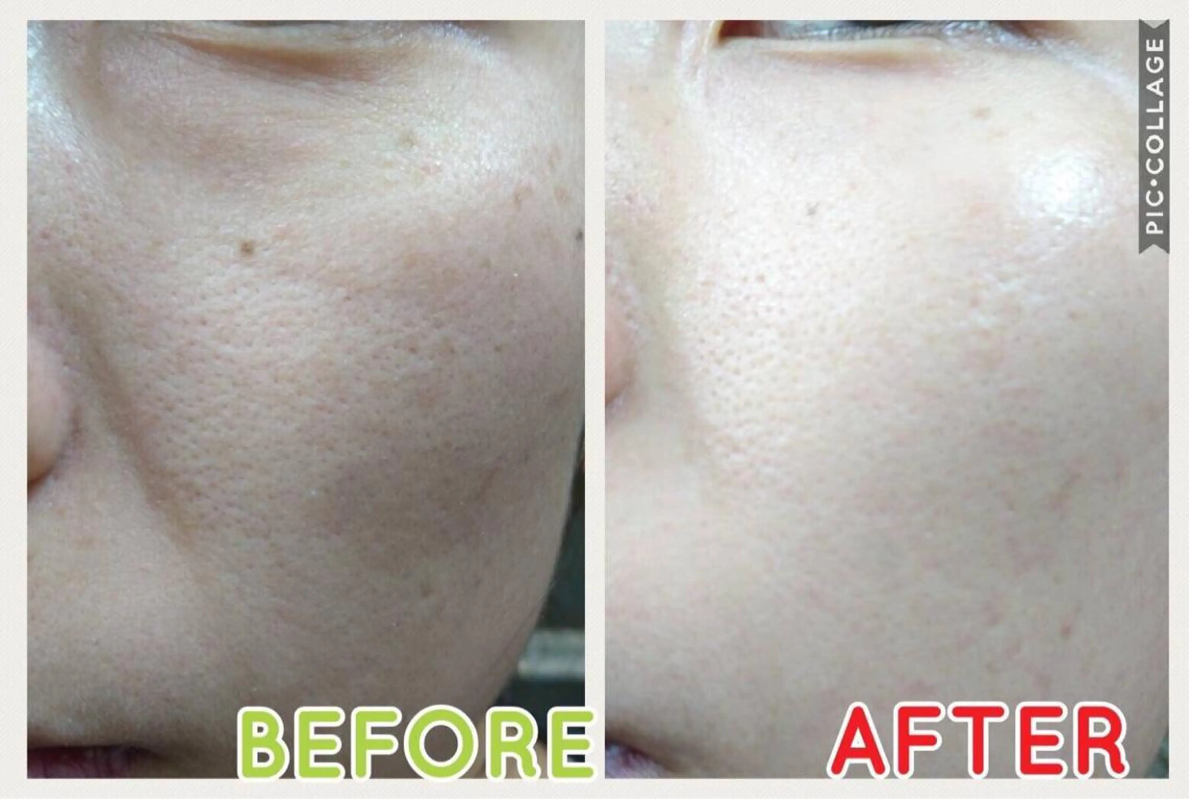 ミディアム カラー パーマ ヘアアレンジ メンズ キッズ ネイル マツエク・マツパ 肌質体質を変えて すっぴん肌にのエステ・リラクイメージ