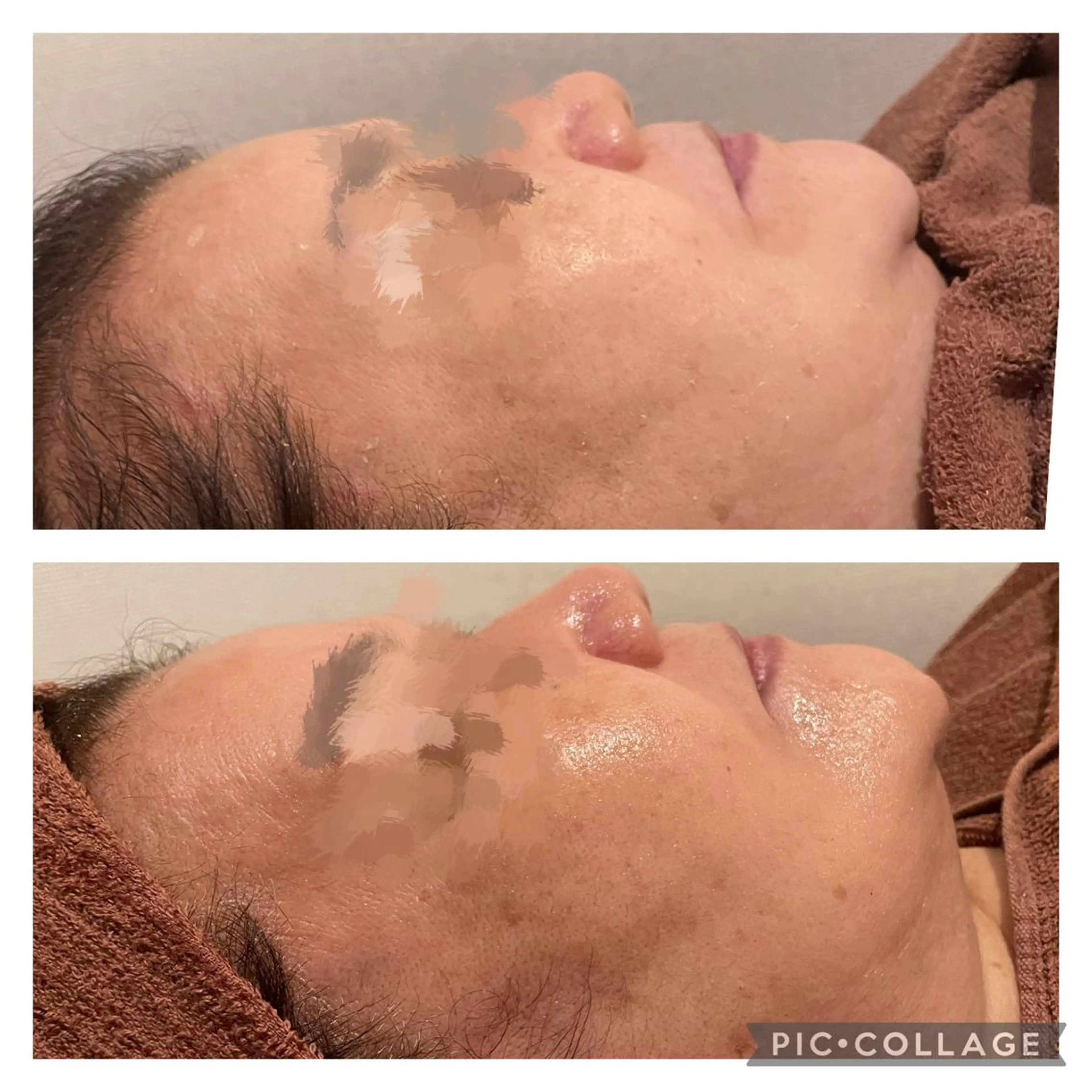 ロング カラー パーマ ヘアアレンジ メンズ キッズ ネイル マツエク・マツパ アイブロウ エステ リラク ニキビ特化型エステ 🍓最短で肌質改善のエステ・リラクイメージ