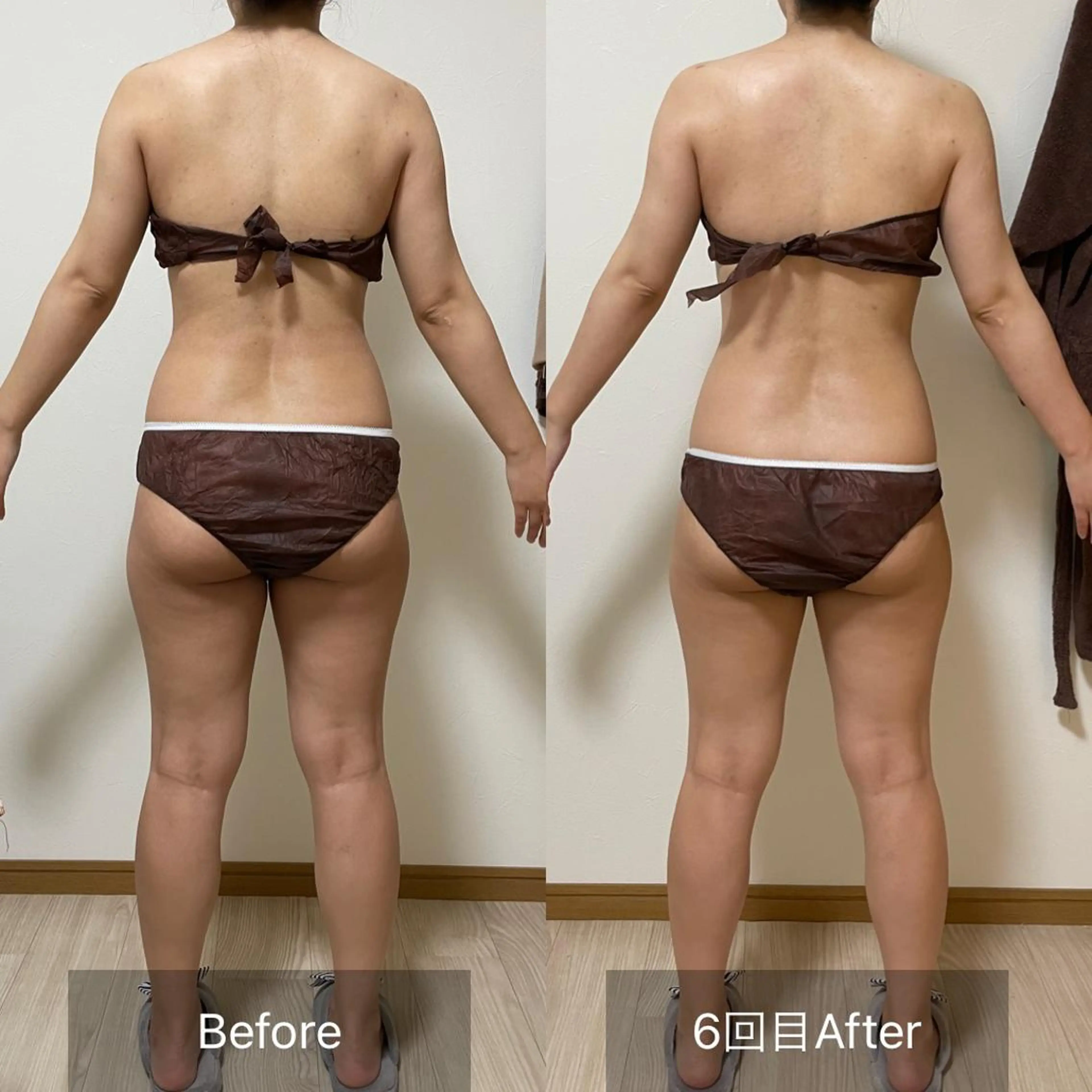 未病ケアサロン　EMINY所属・未病ケアサロン EMINY☺︎勝俣のエステ・リラクイメージ