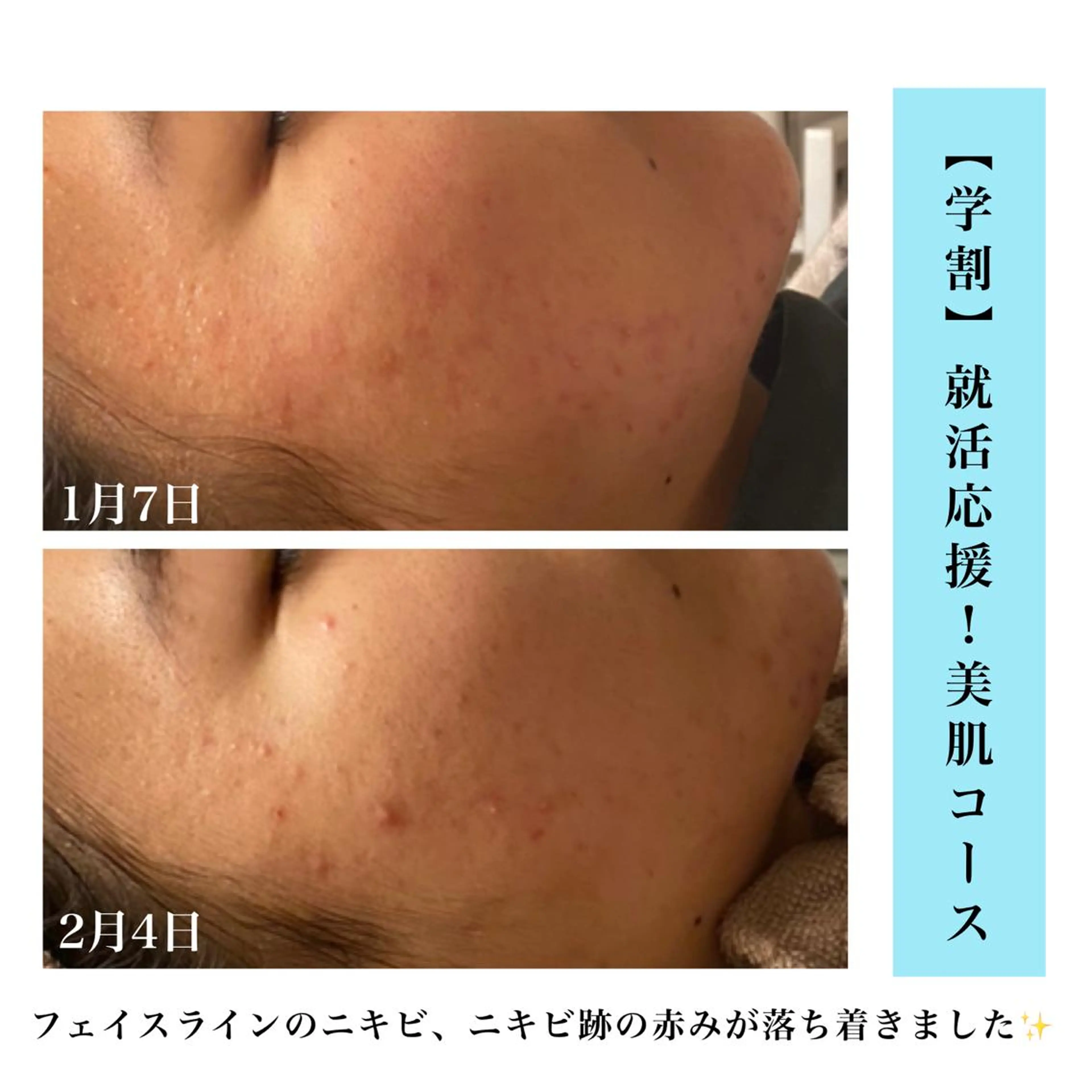 エステ Bellesthe （ベルエステ）のエステ・リラクイメージ