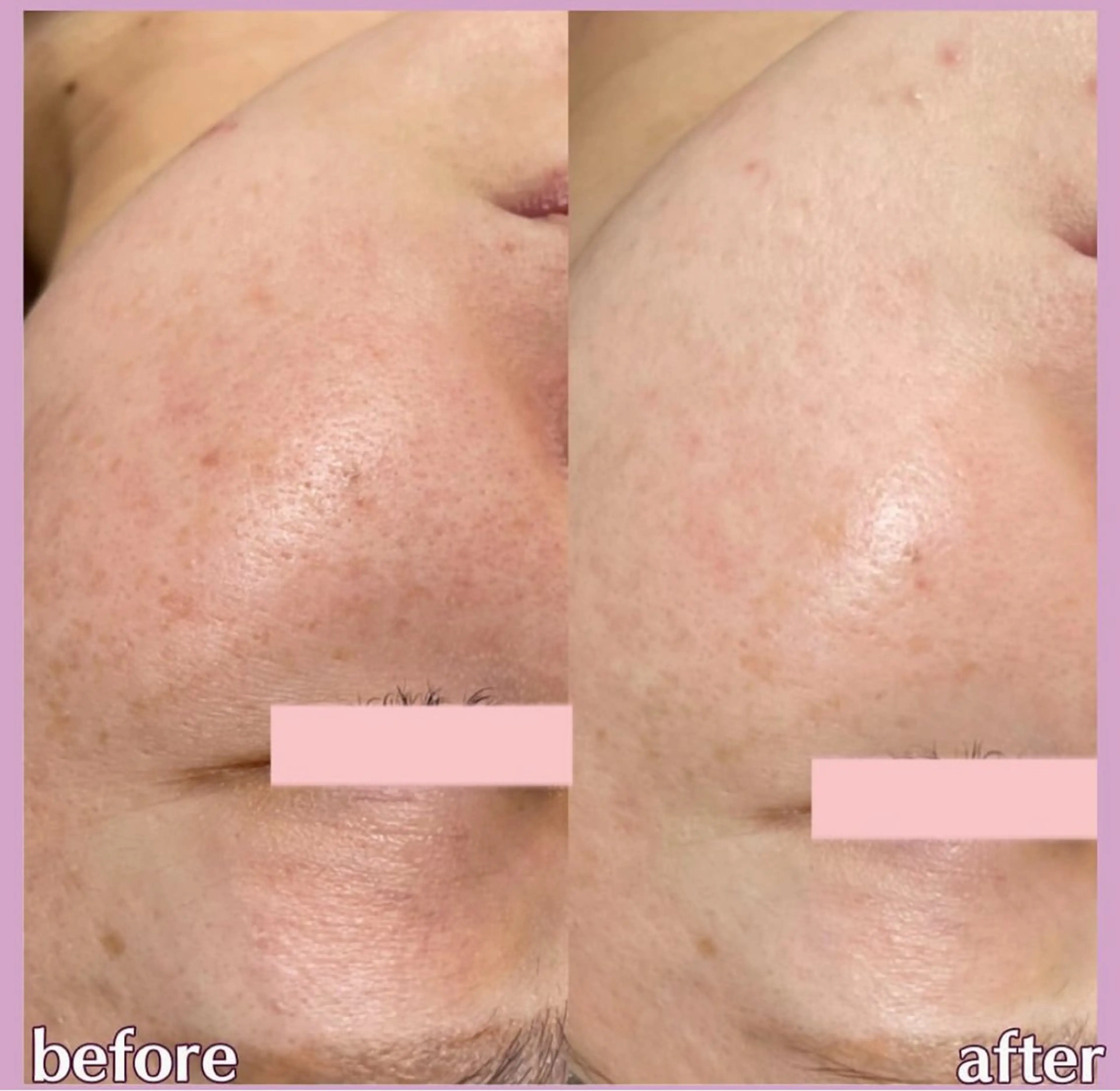 salon lady_goのマツエク・マツパデザイン