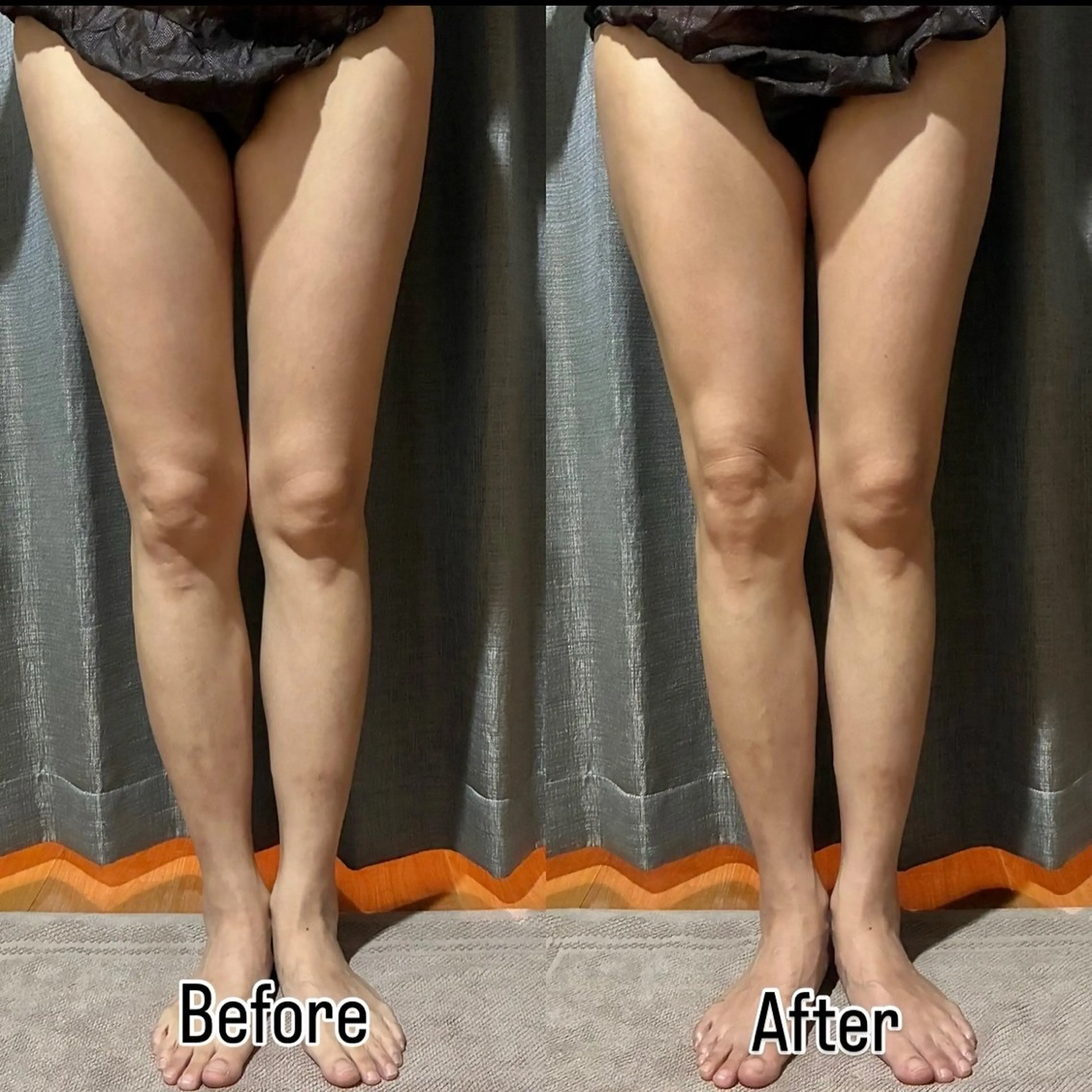 Lumiere所属・Lumiere （ルミエール）のエステ・リラクイメージ