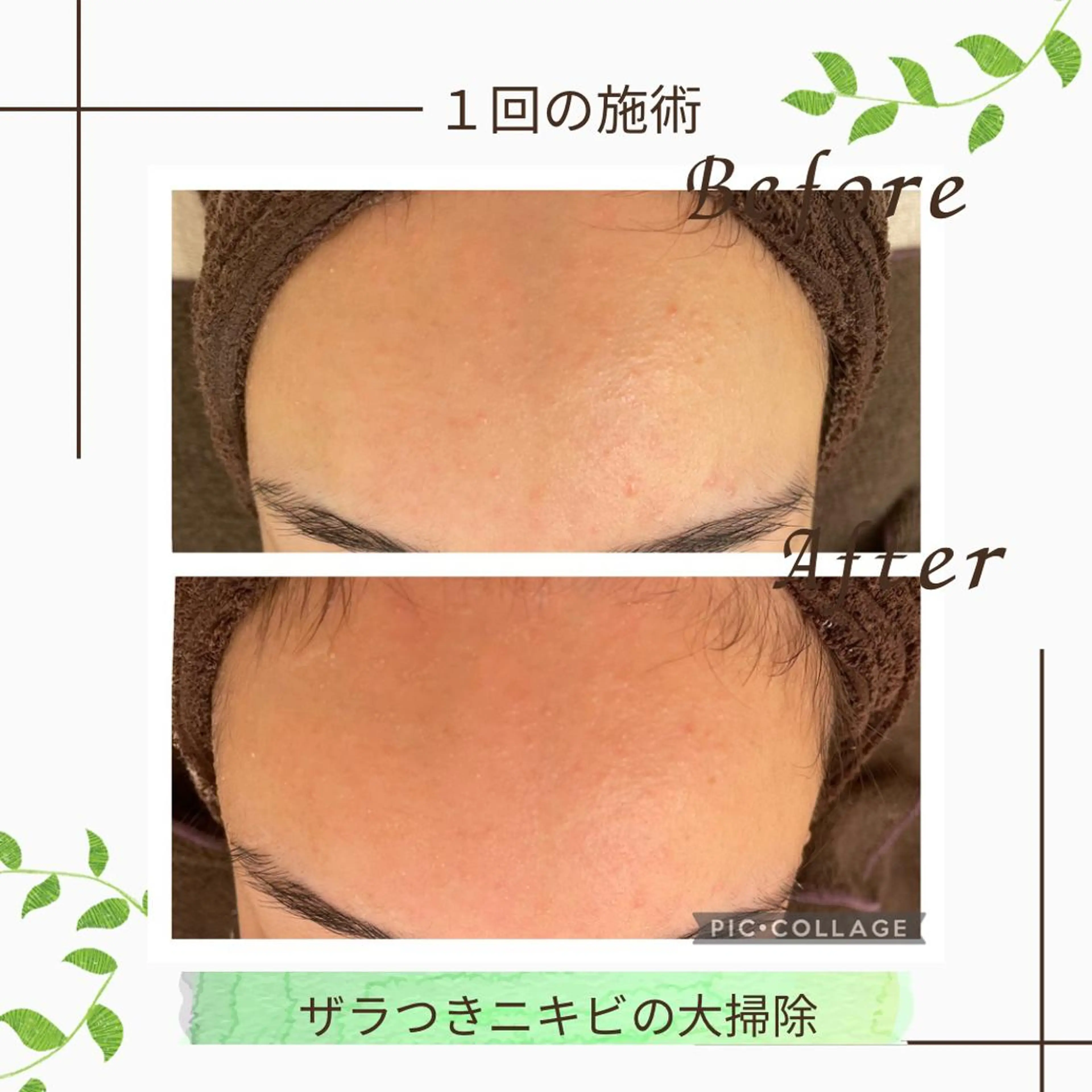 ニキビ改善サロン　縁樹　enju所属・ニキビ専門サロン縁樹 鈴木真樹のエステ・リラクイメージ