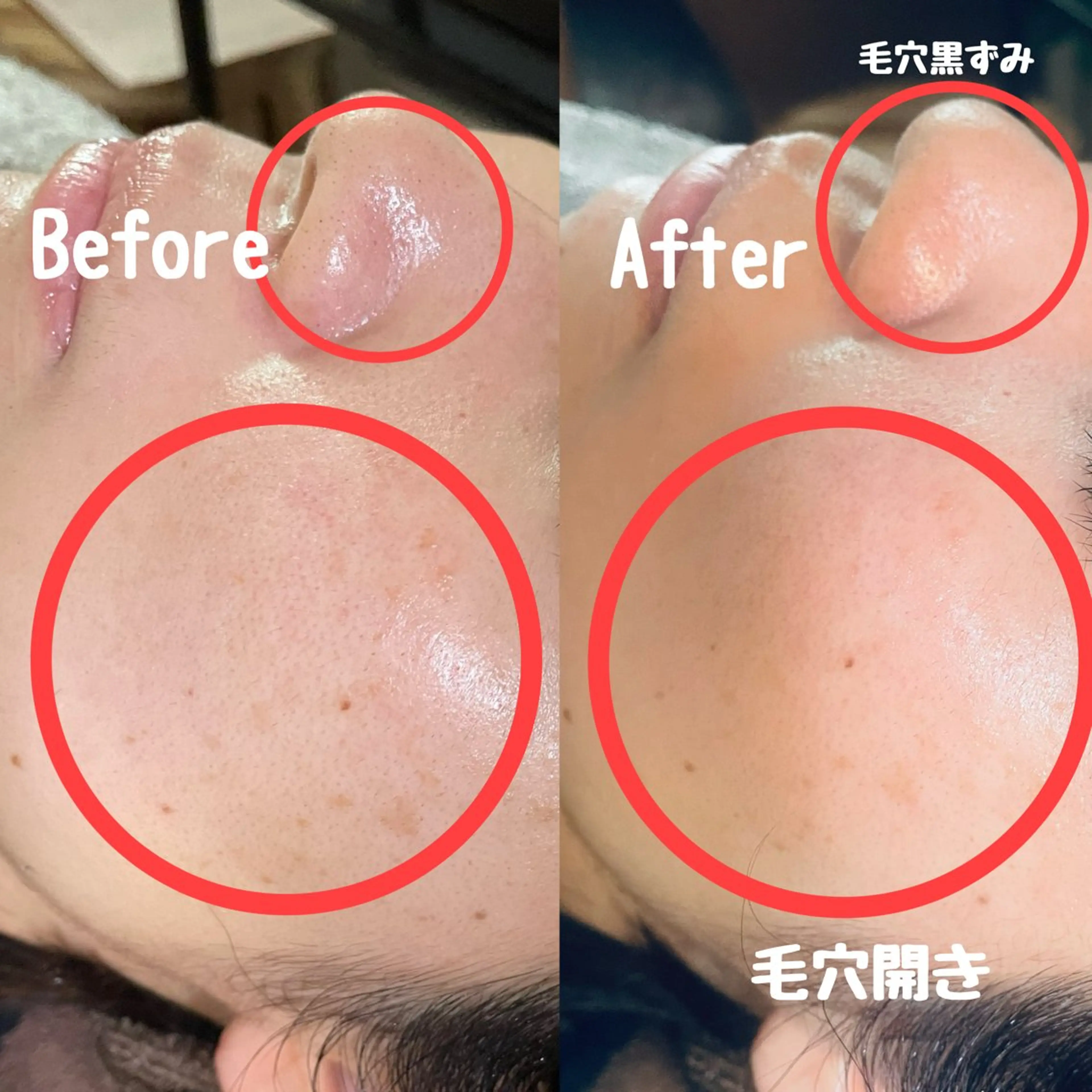 エステ リラク Surien 水脇ゆうのその他イメージ