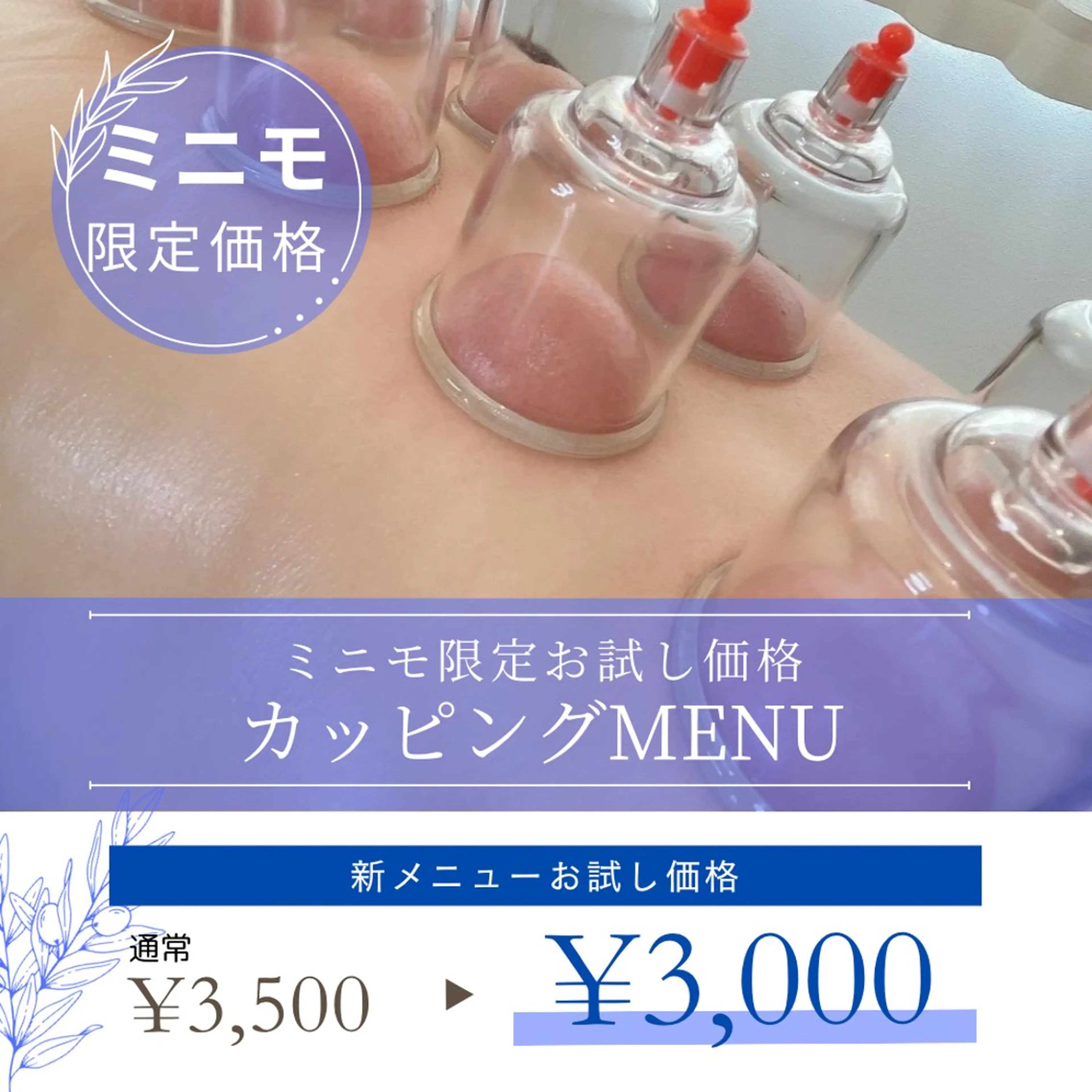 ミニモ限定🧡【むくみ撃退👊】人気の吸玉💫足と背中スッキリカッピングの写真