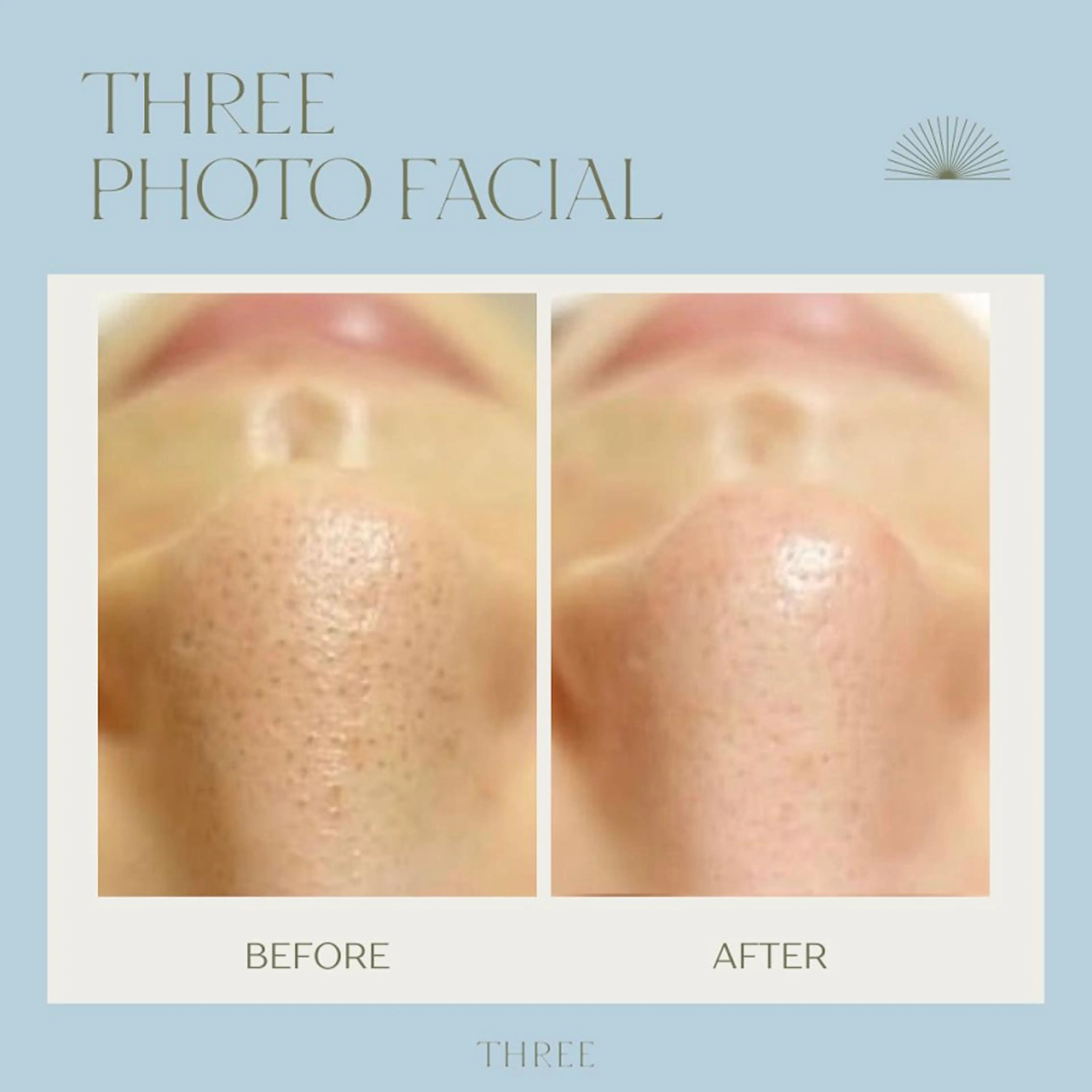 メンズ キッズ 福留 千春のエステ・リラクイメージ