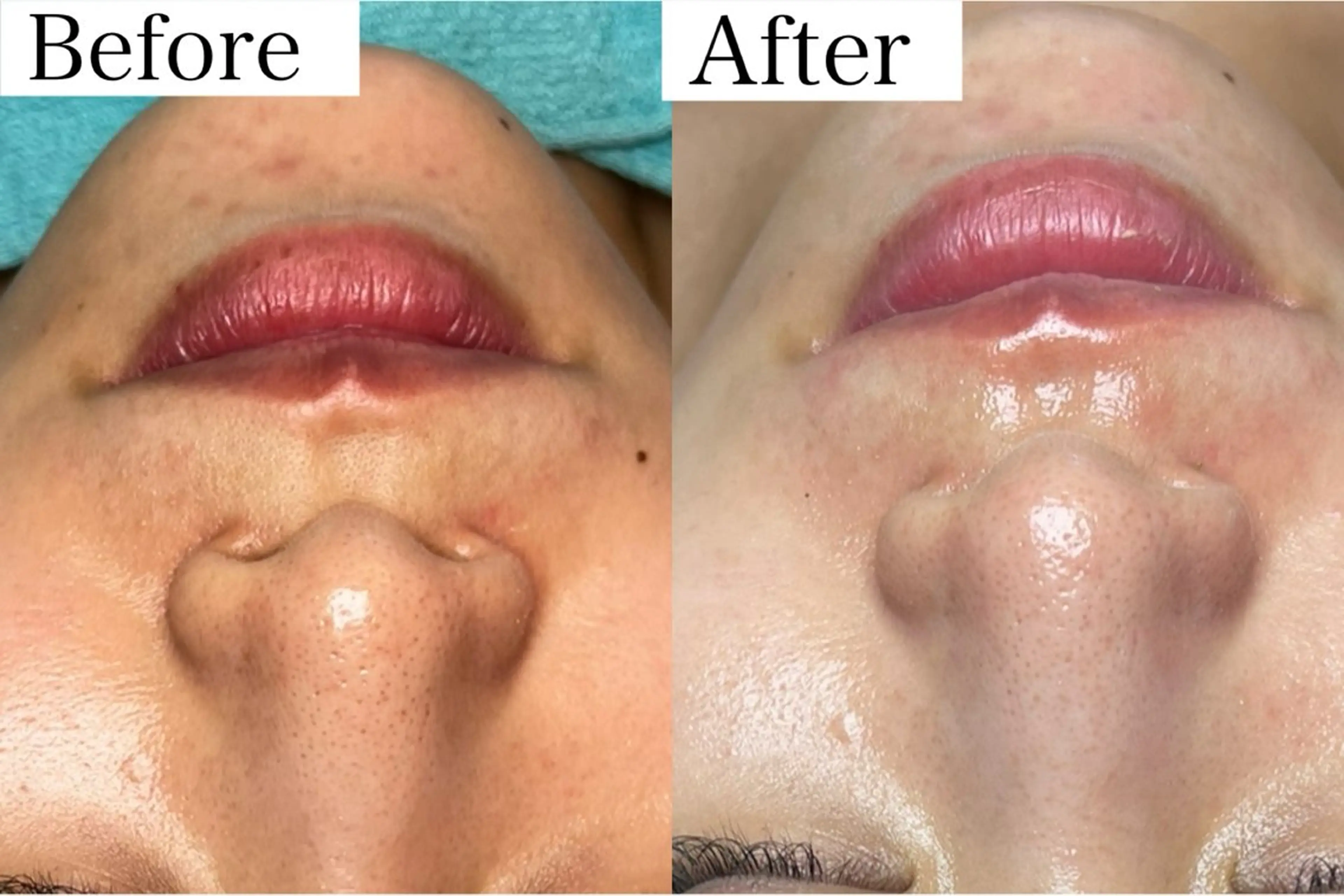 潤い艶肌／肌質改善 YUKAのエステ・リラクイメージ