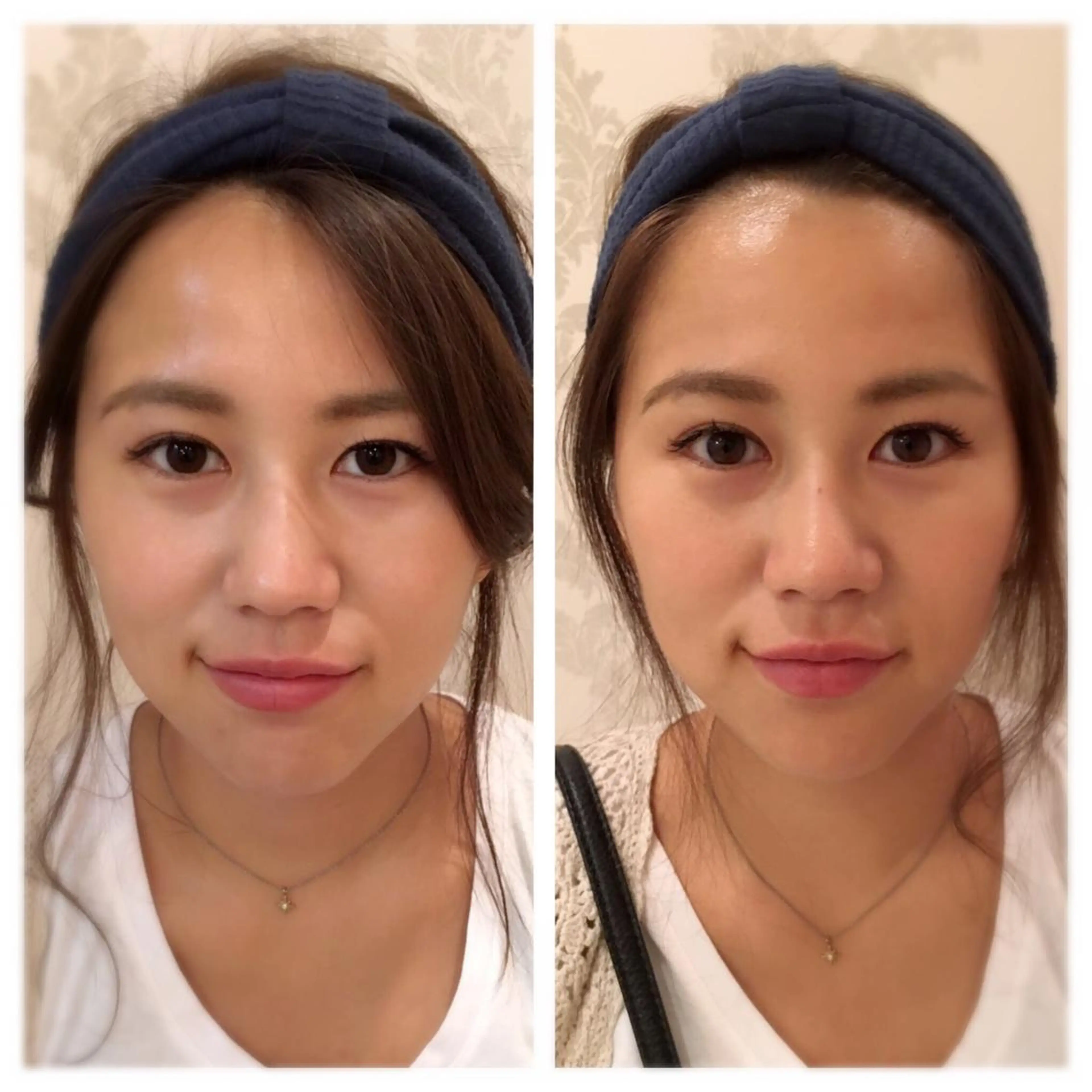 美容鍼サロン    Fleurir所属・伊藤 かなえのエステ・リラクイメージ