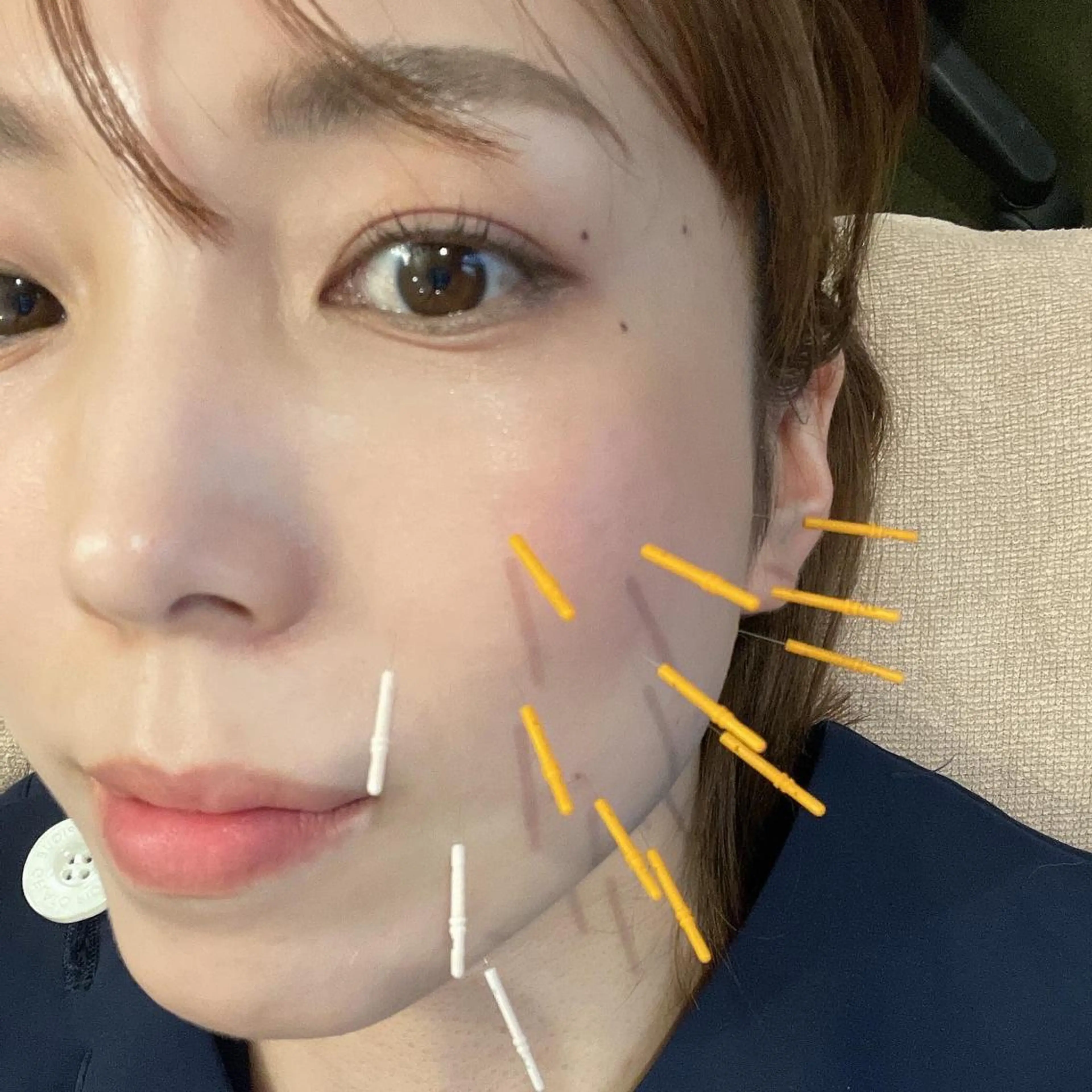 美容鍼　蒼月-aotsuki-所属・美容鍼「蒼月」 -アオツキ-のエステ・リラクイメージ